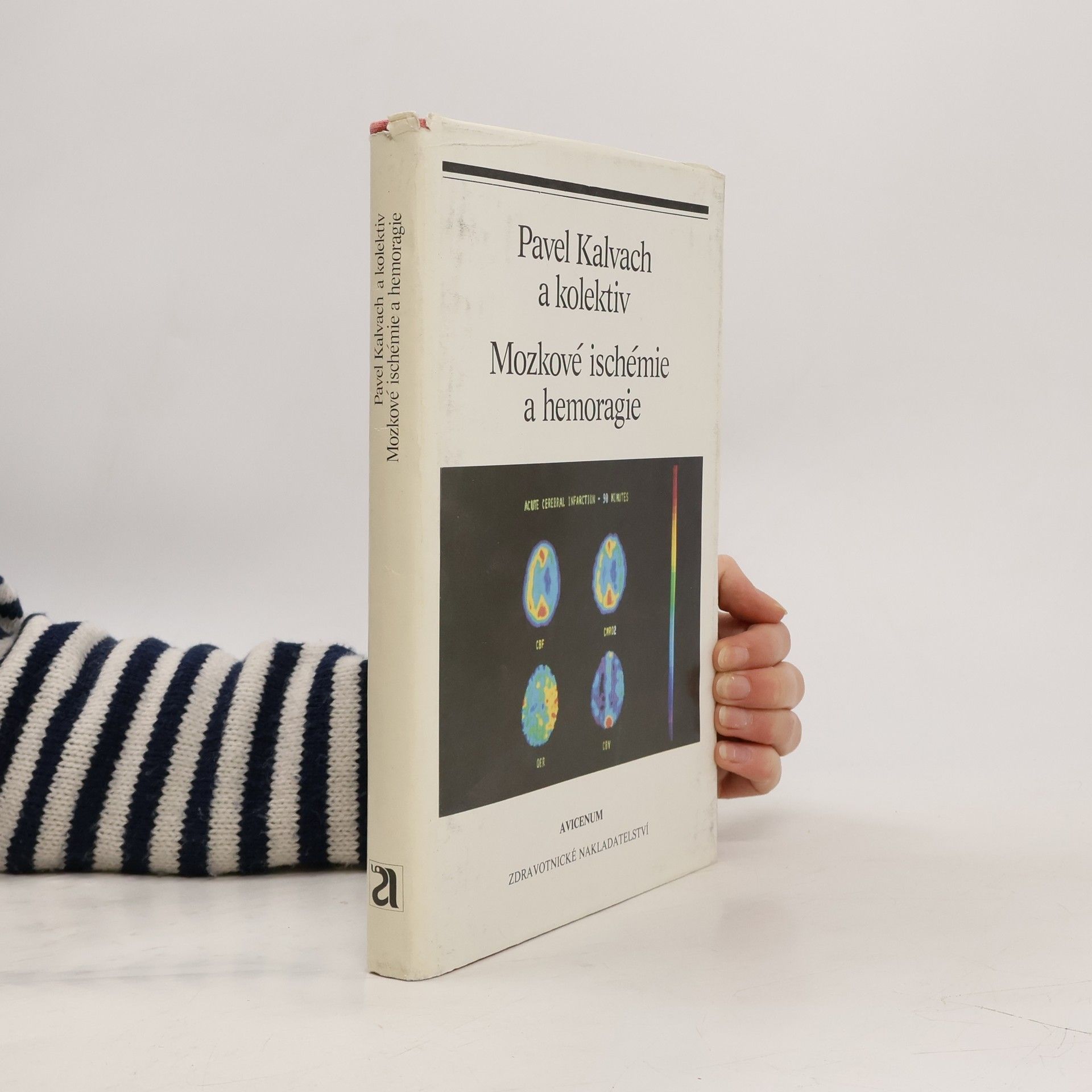 Mozkové ischemie a hemoragie