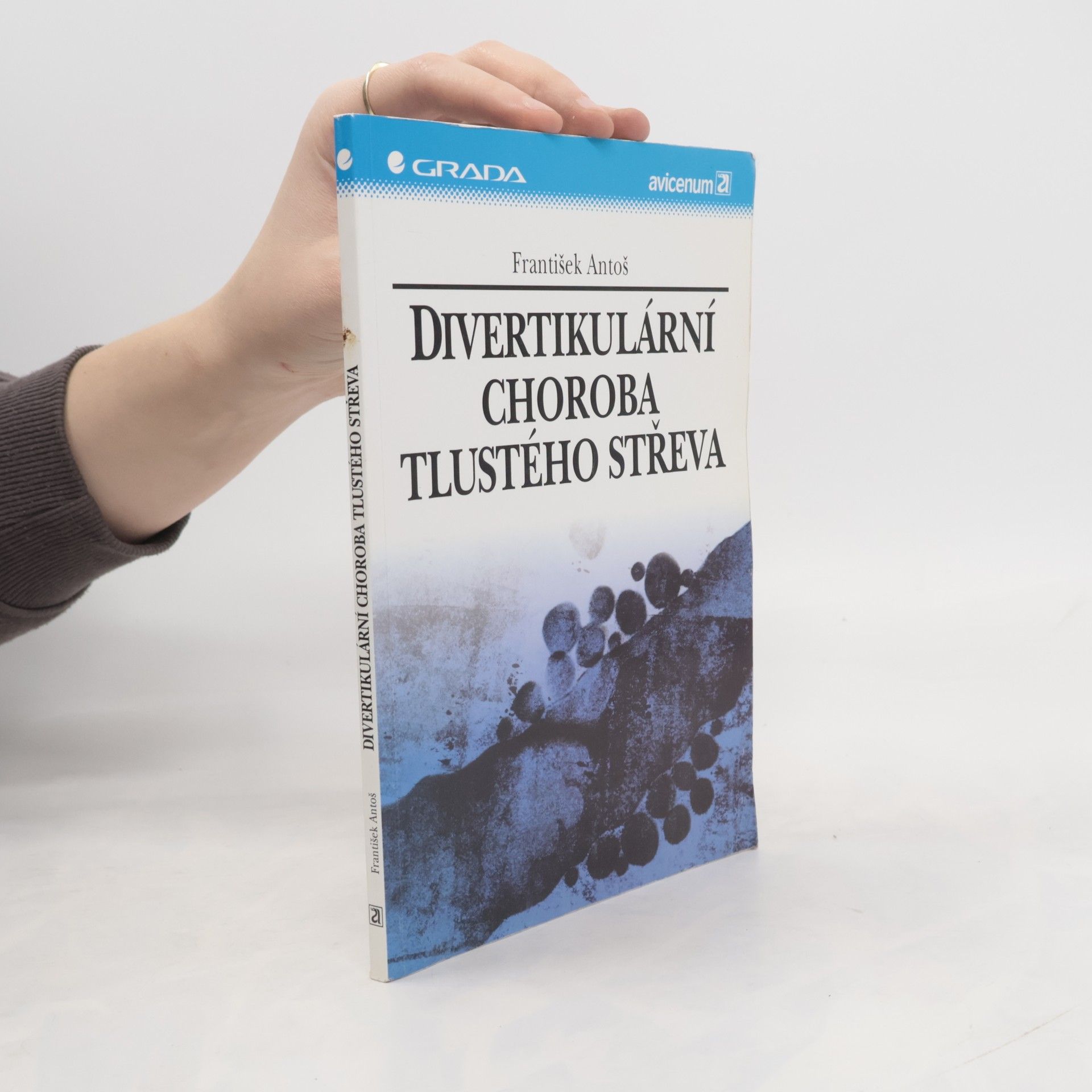 František Antoš Divertikulární choroba tlustého střeva