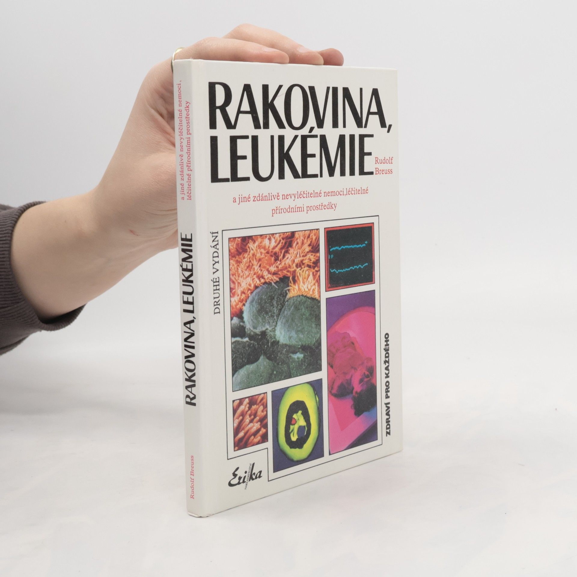 Rudolf Breuss Rakovina, leukémie a jiné zdánlivě nevyléčitelné nemoci, které jsou léčitelné přírodními prostředky: Záznamy z tisíců zkušeností k blahu všeho lidstva na přání mnoha vyléčených pacientů a také na přání dobrých lékařů