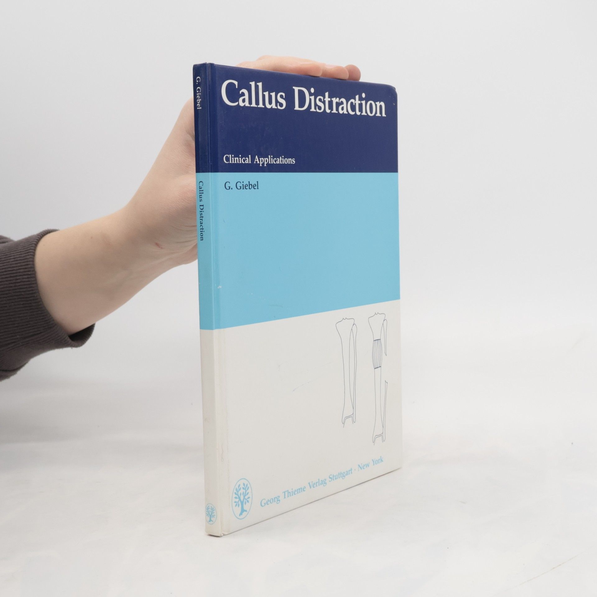Callus Distraction