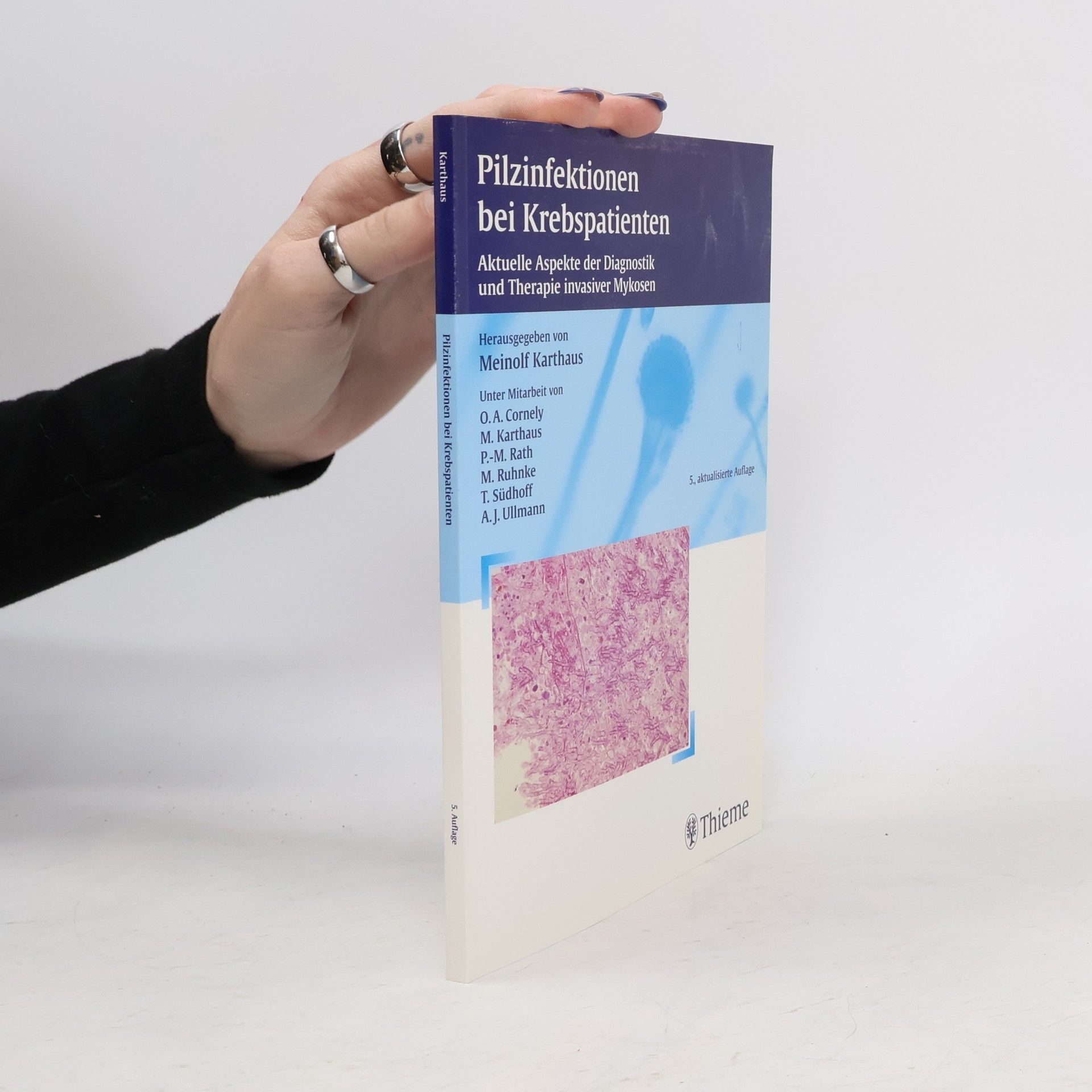 Meinolf Karthaus Pilzinfektionen bei Krebspatienten