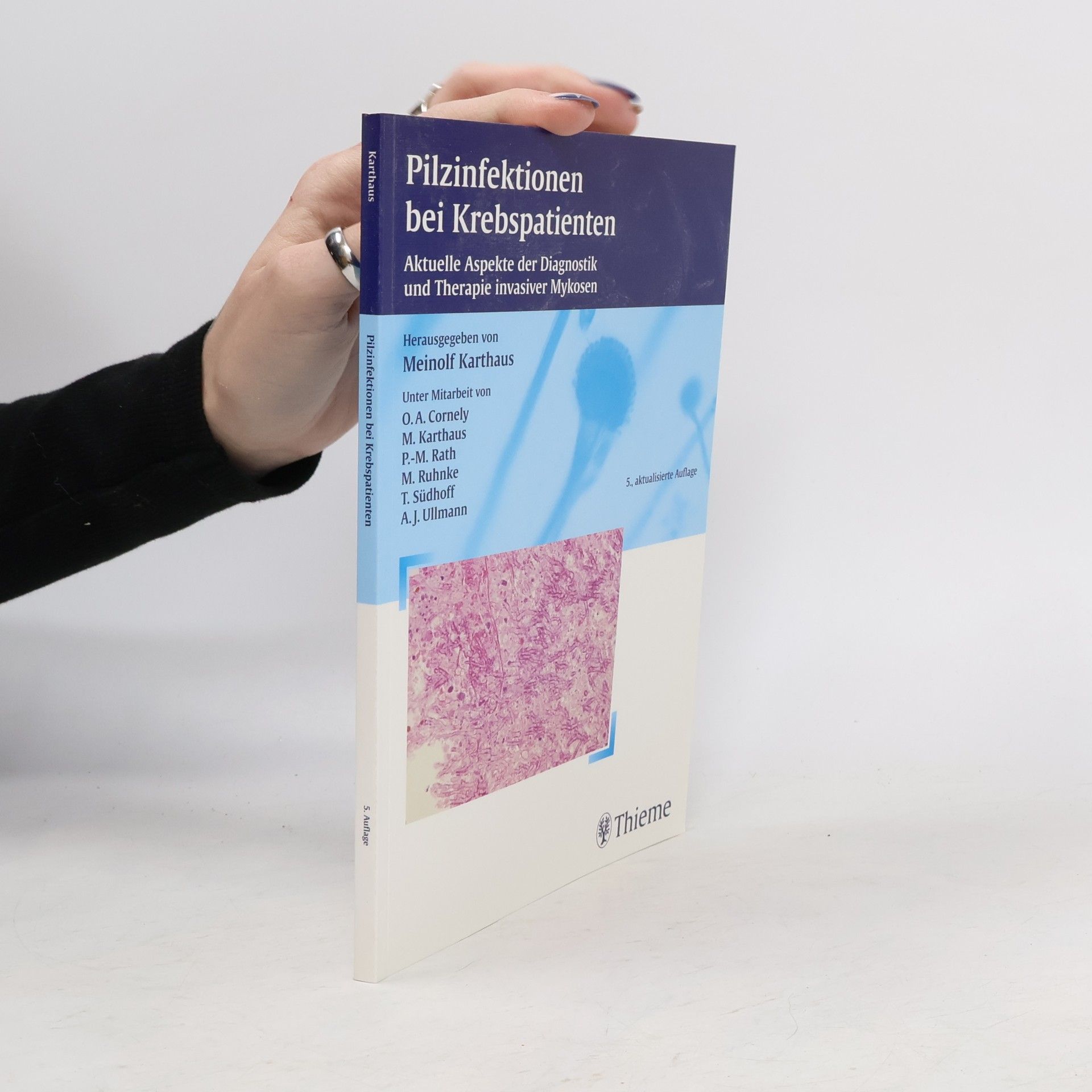 Meinolf Karthaus Pilzinfektionen bei Krebspatienten