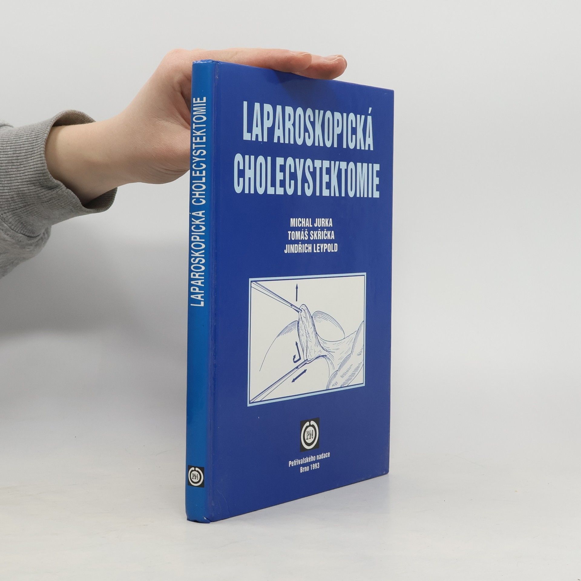 Michal Jurka Laparoskopická cholecystektomie