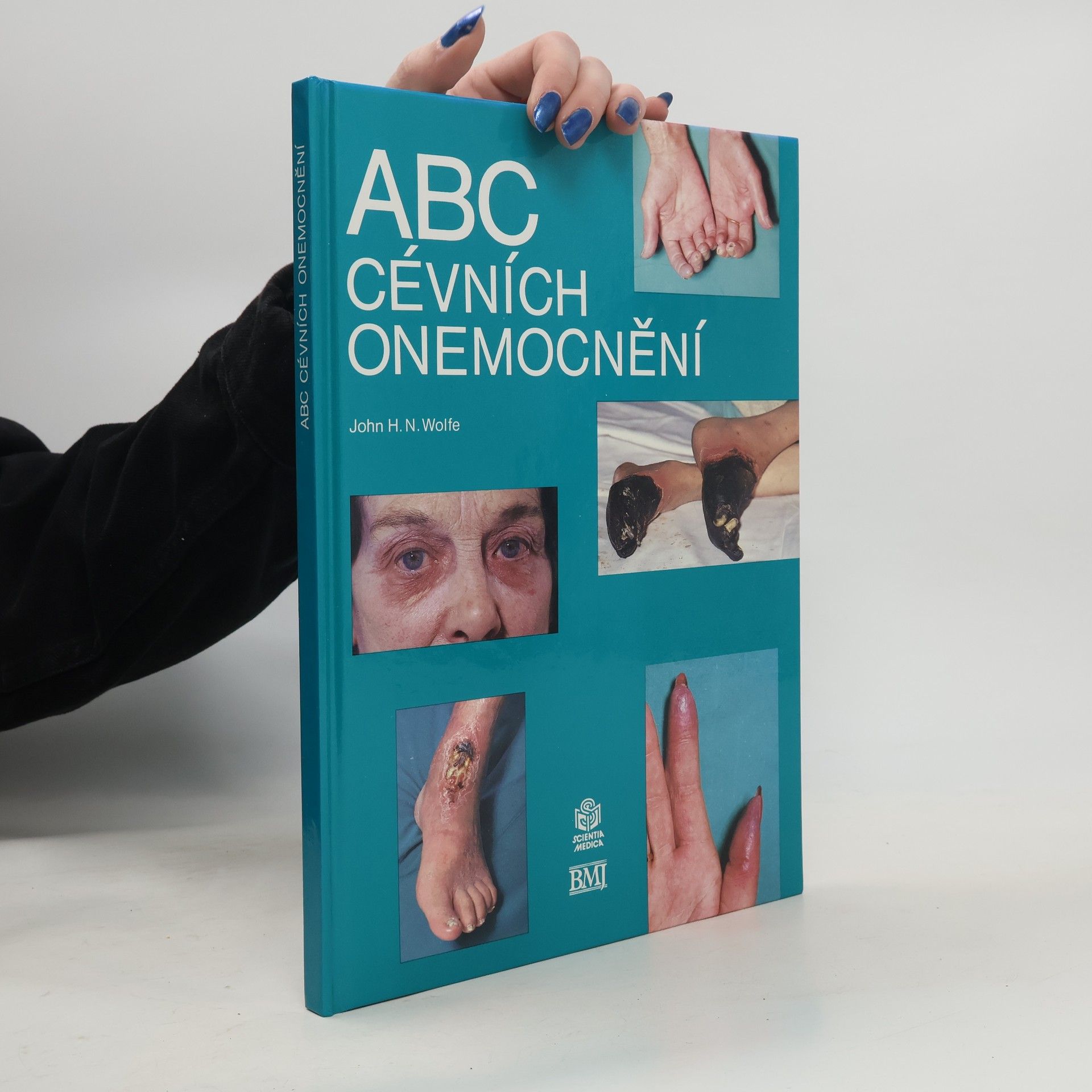 ABC cévních onemocnění