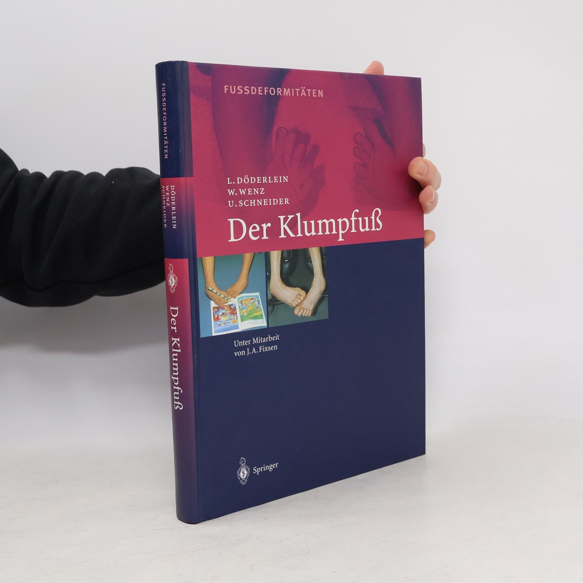 Leonhard Döderlein Fussdeformitäten