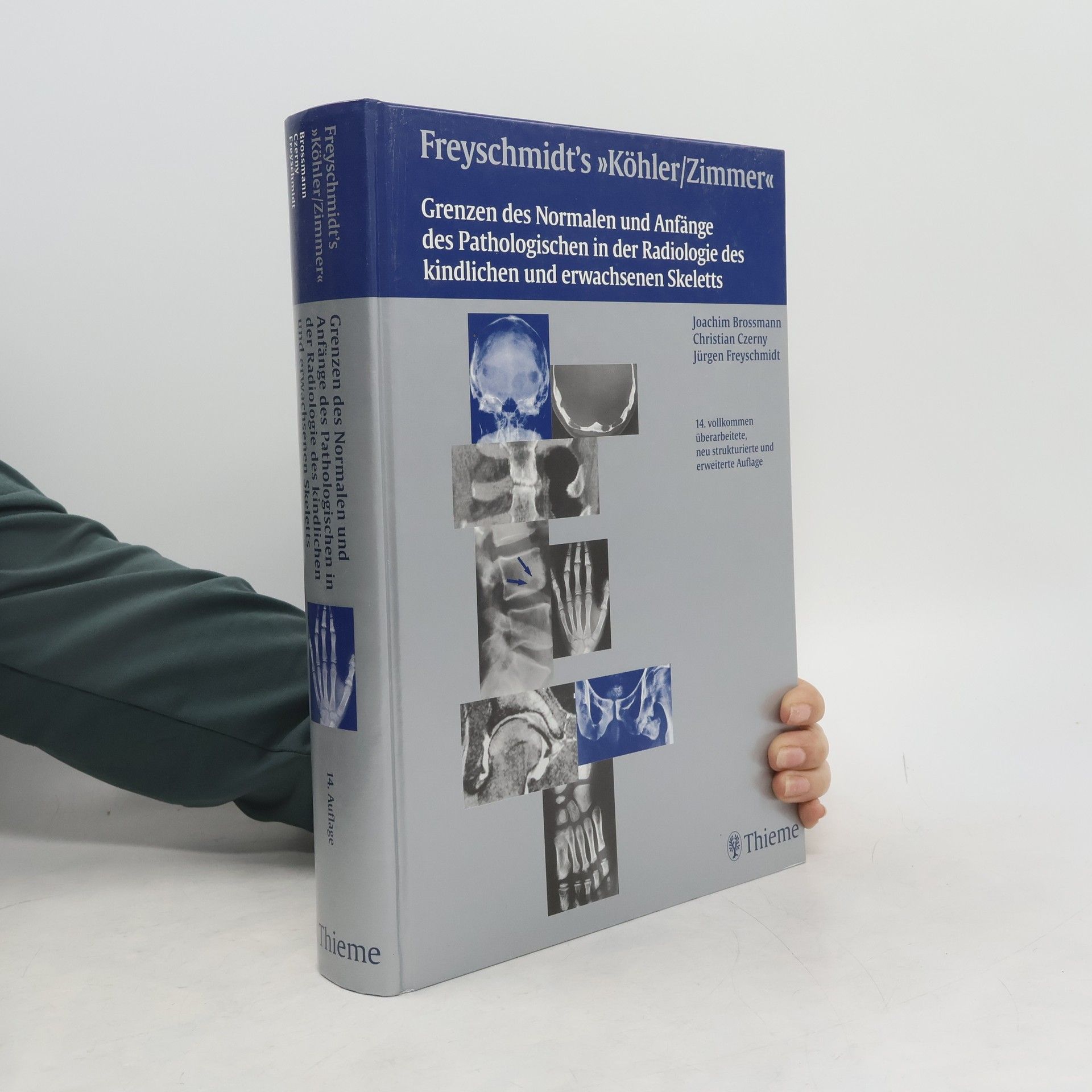 Jürgen Freyschmidt Freyschmidt's 'Köhler/Zimmer': Grenzen des Normalen und Anfänge des Pathologischen in der Radiologie des kindlichen und erwachsenen Skeletts – 14. vollkommen überarbeitete, neu strukturierte und erweiterte Auflage
