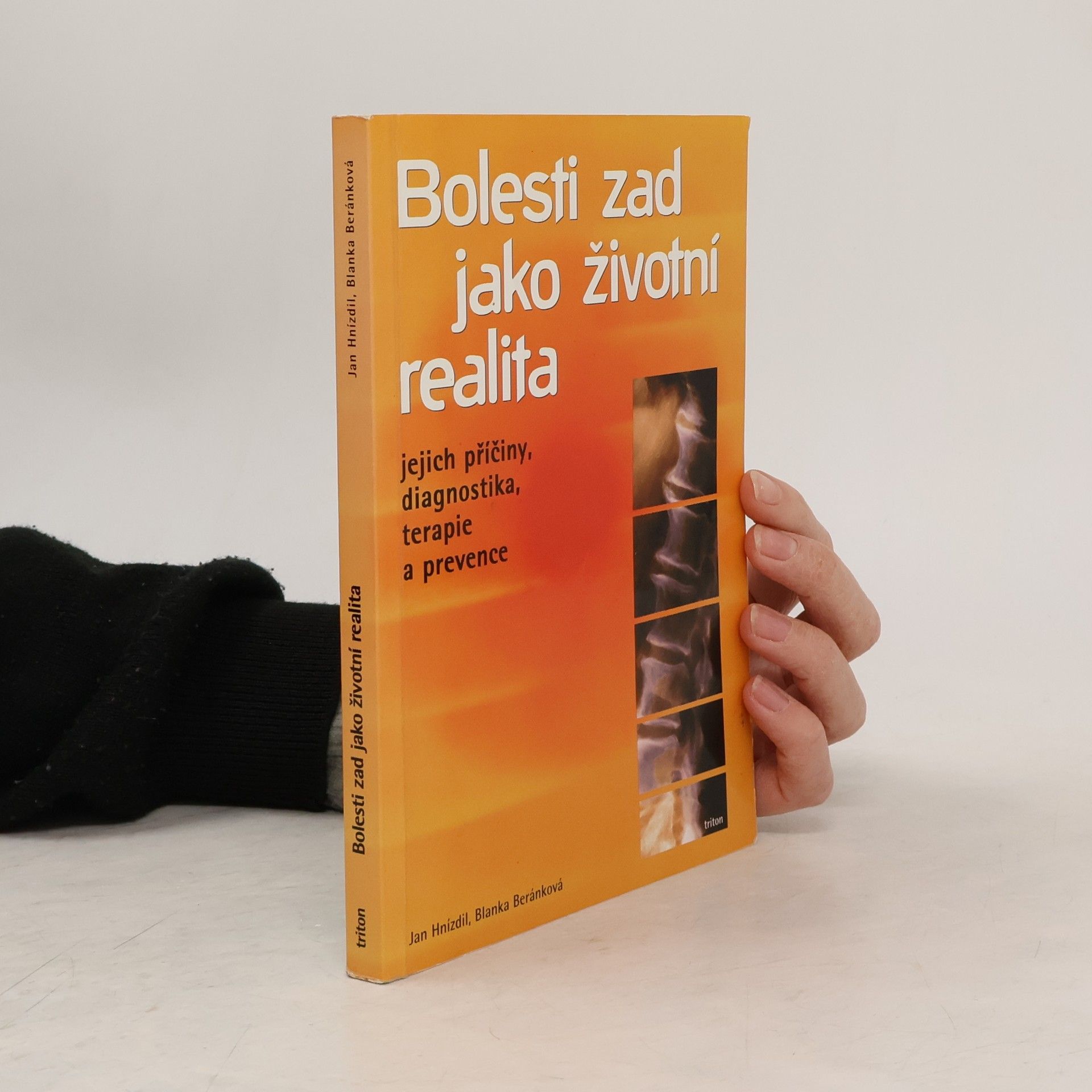 Jan Hnízdil Bolesti zad jako životní realita. Jejich příčiny, diagnostika, terapie a prevence