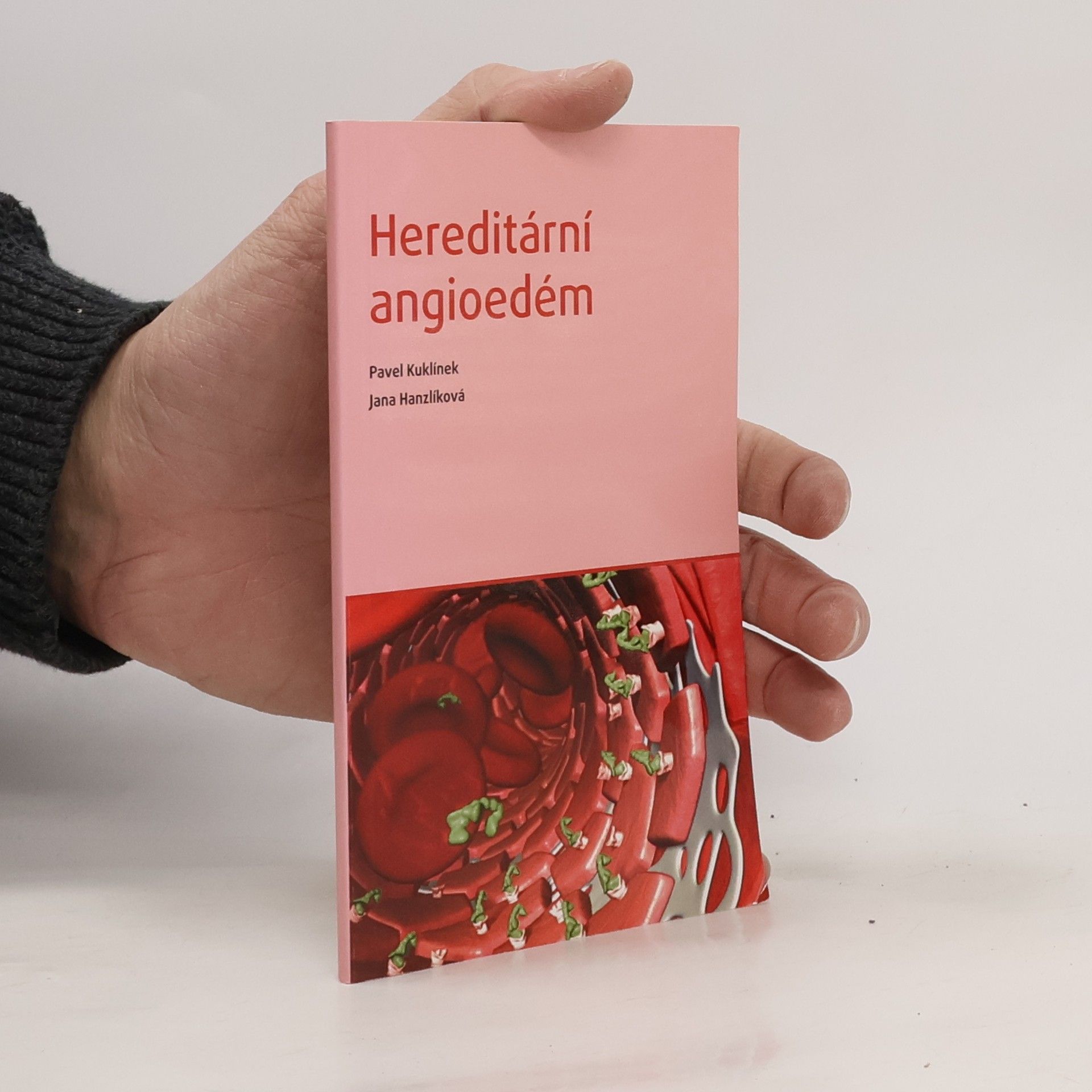 Hereditární angioedém