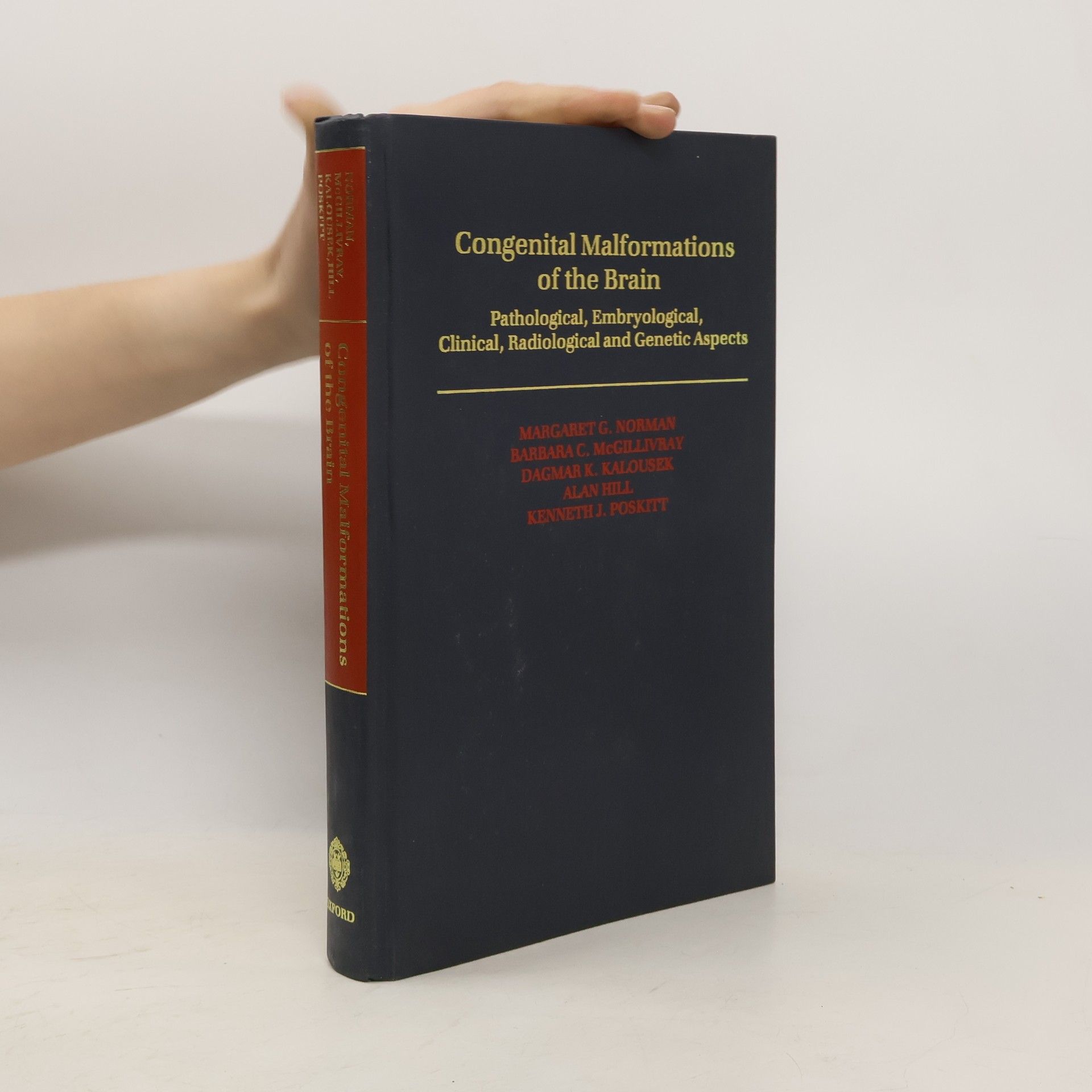 Margaret Grace Norman Congenital Malformations of the Brain