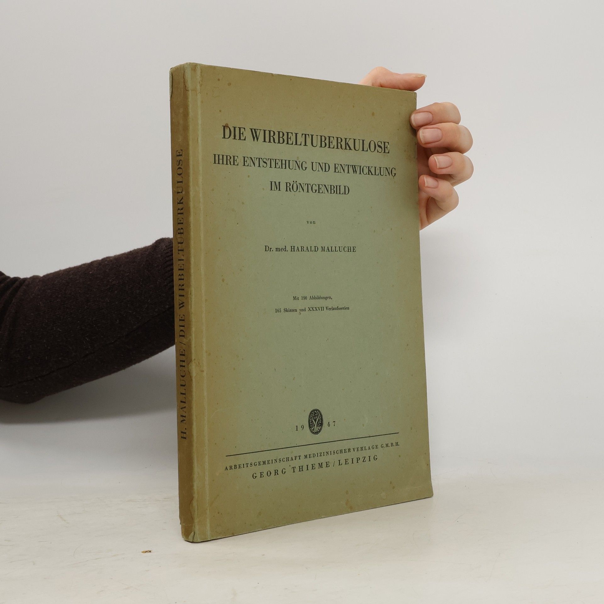 Harald Malluche Die Wirbeltuberkulose, ihre Entstehung und Entwicklung im Röntgenbild