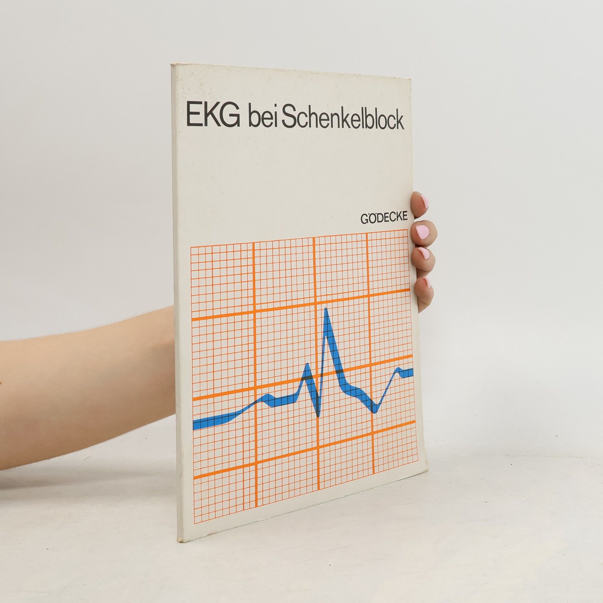 Autorenkollektiv EKG bei Schenkelblock