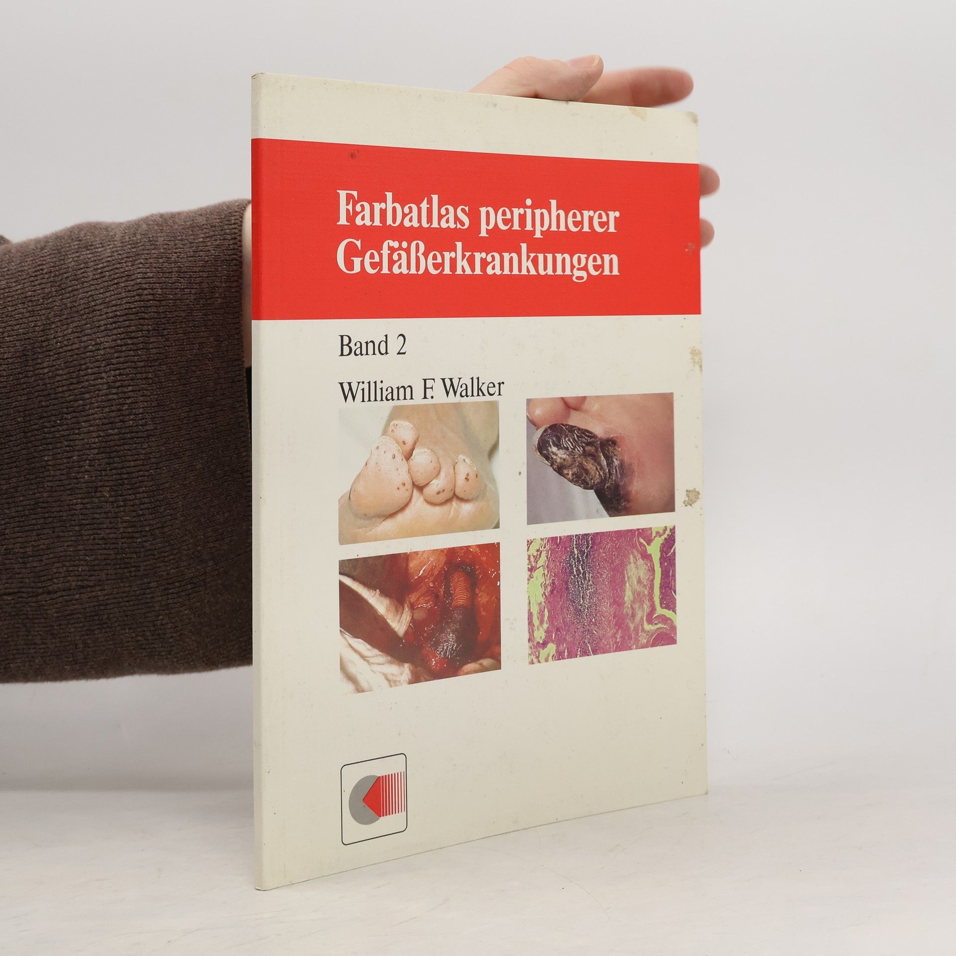 William F. Walker Farbatlas peripherer Gefässerkrankungen. Band 2.