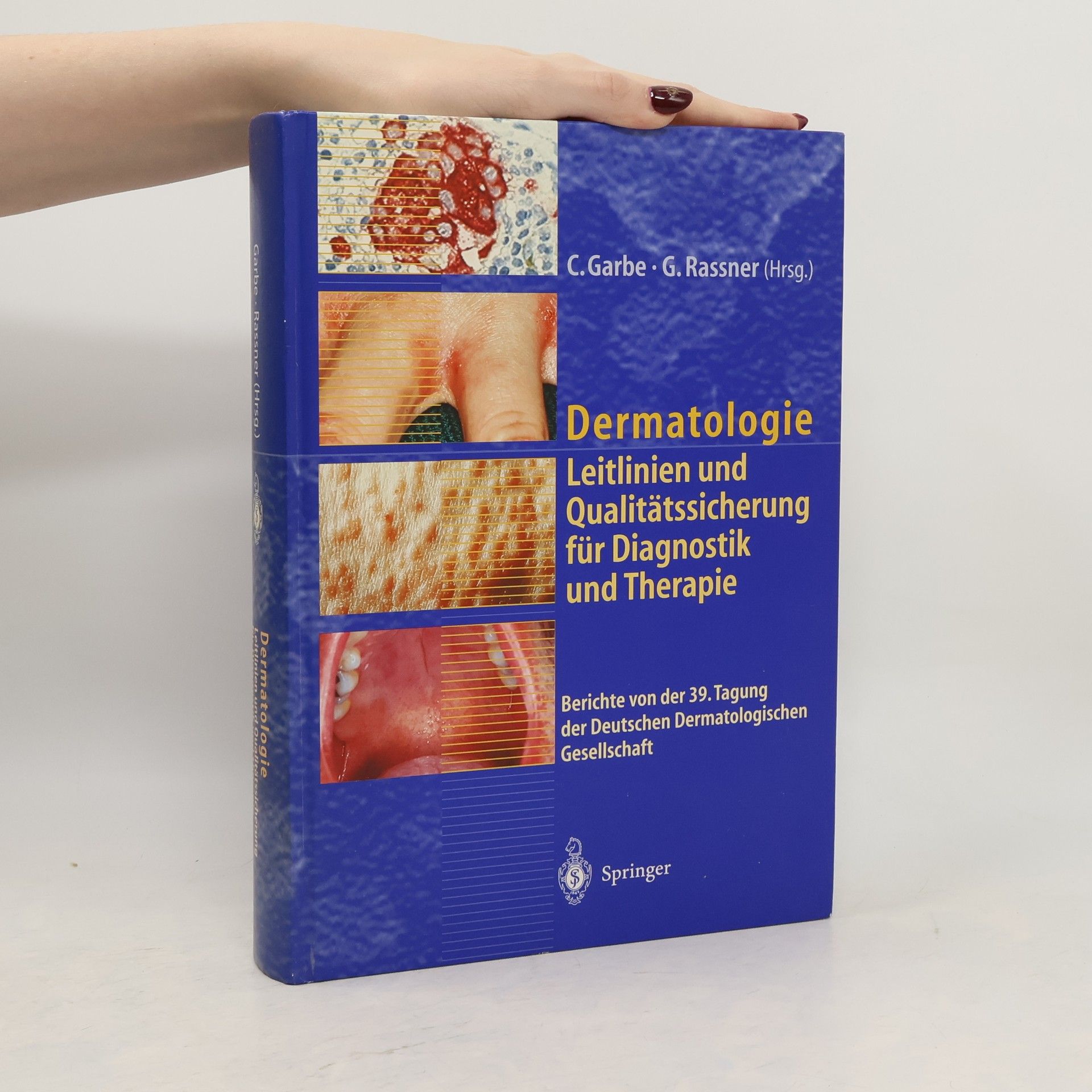 Claus Garbe Dermatologie