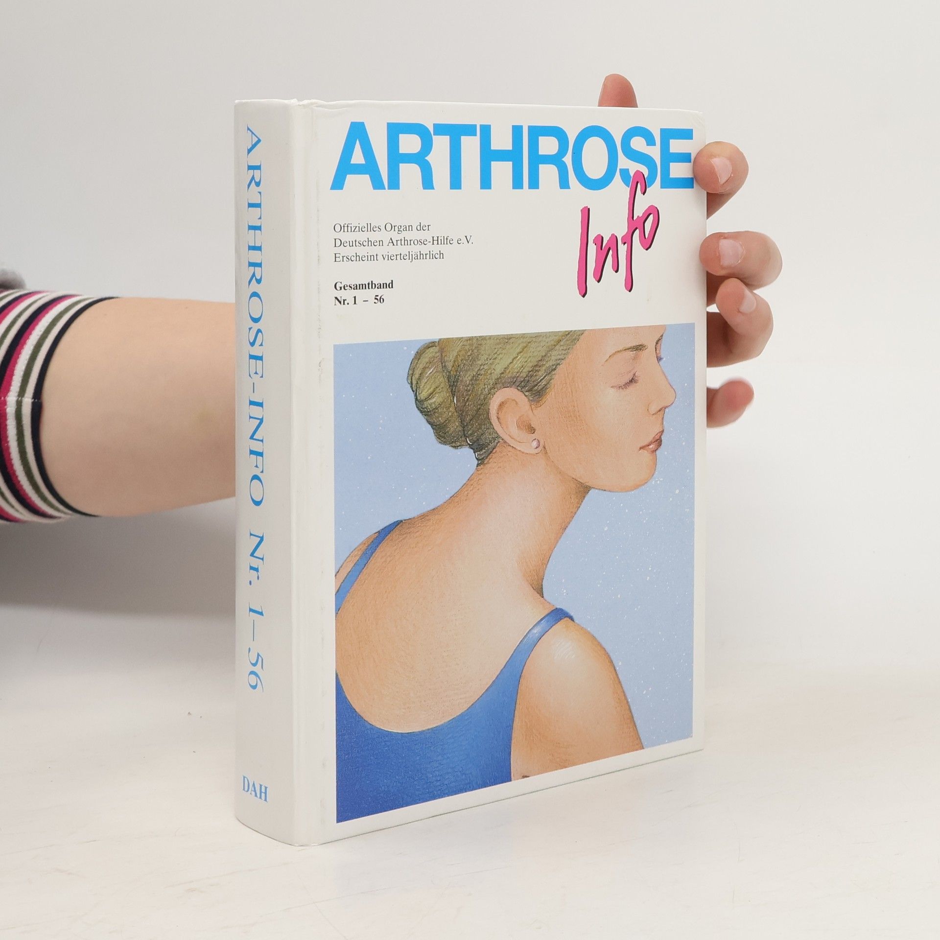 Autorenkollektiv Arthrose-Info Nr. 1-56