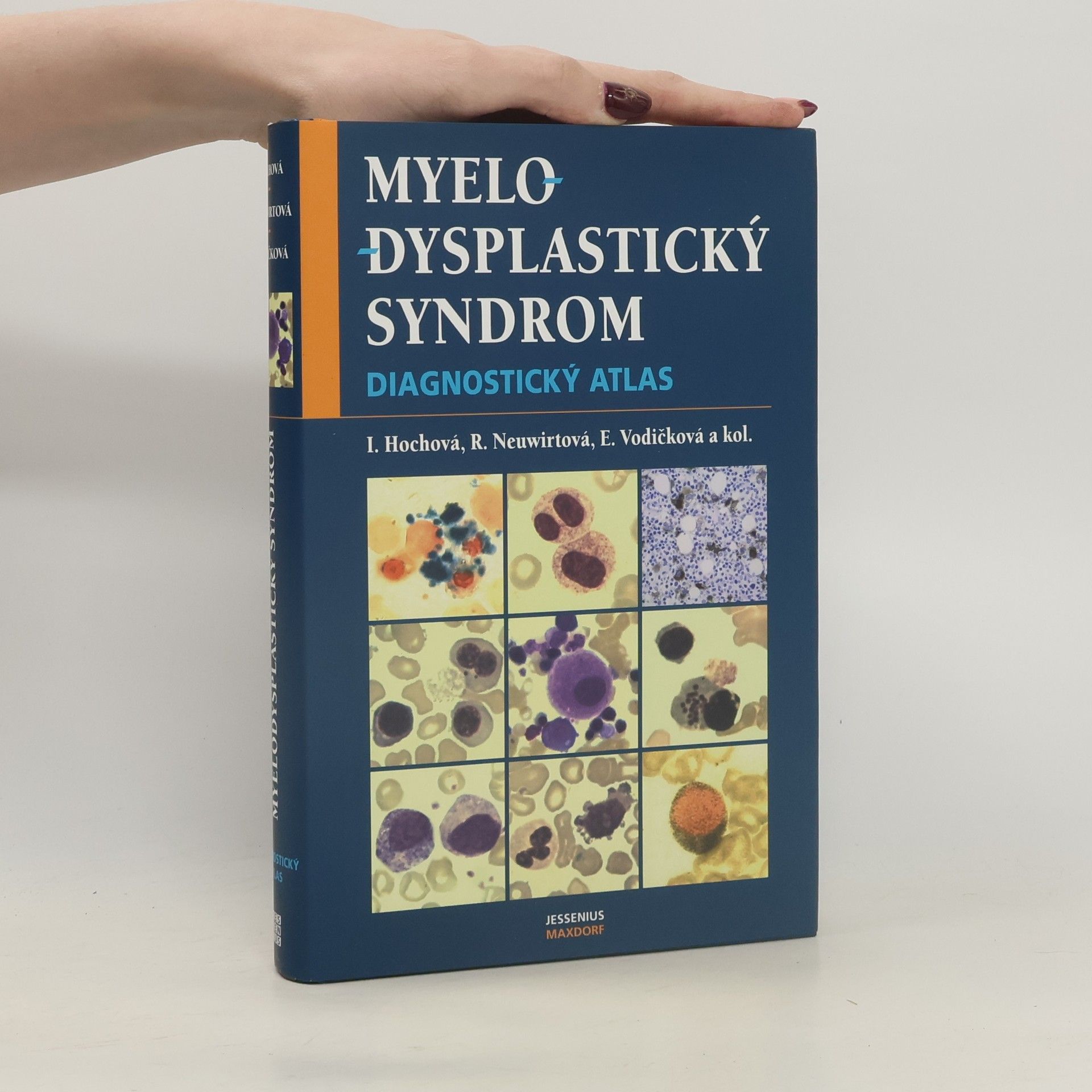 Ivana Hochová Myelodysplastický syndrom