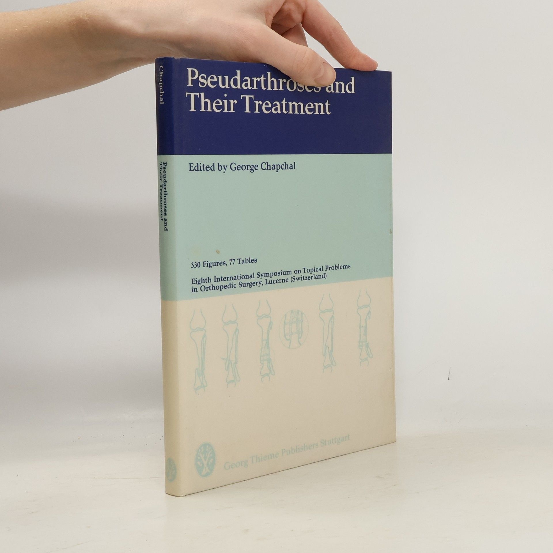 George Chapchal Pseudarthroses and Their Treatment