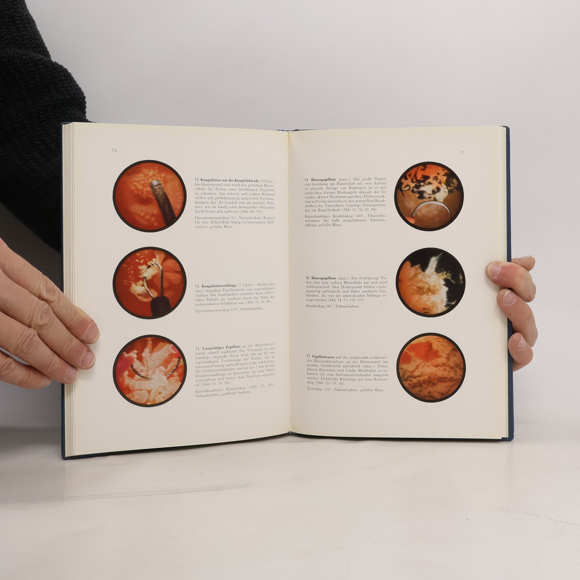 Kolektiv autorů Atlas der urologischen Endoskopie