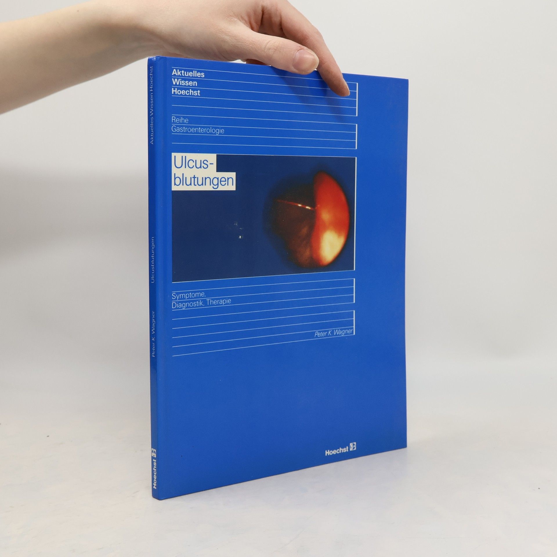 Peter K. Wagner Ulcusblutungen