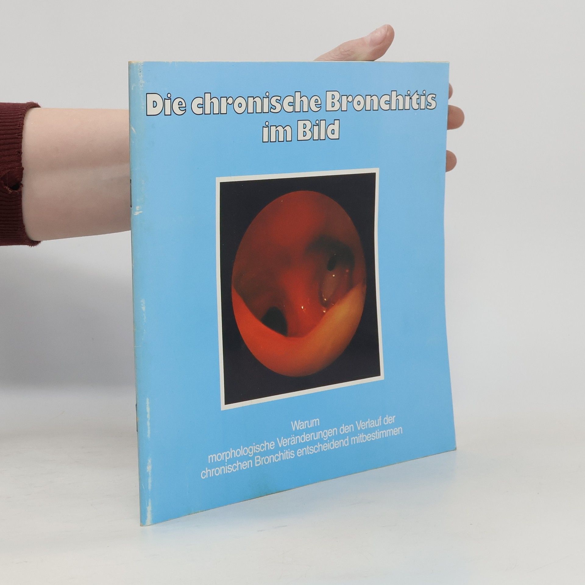 Autorenkollektiv Die chronische Bronchitis im Bild