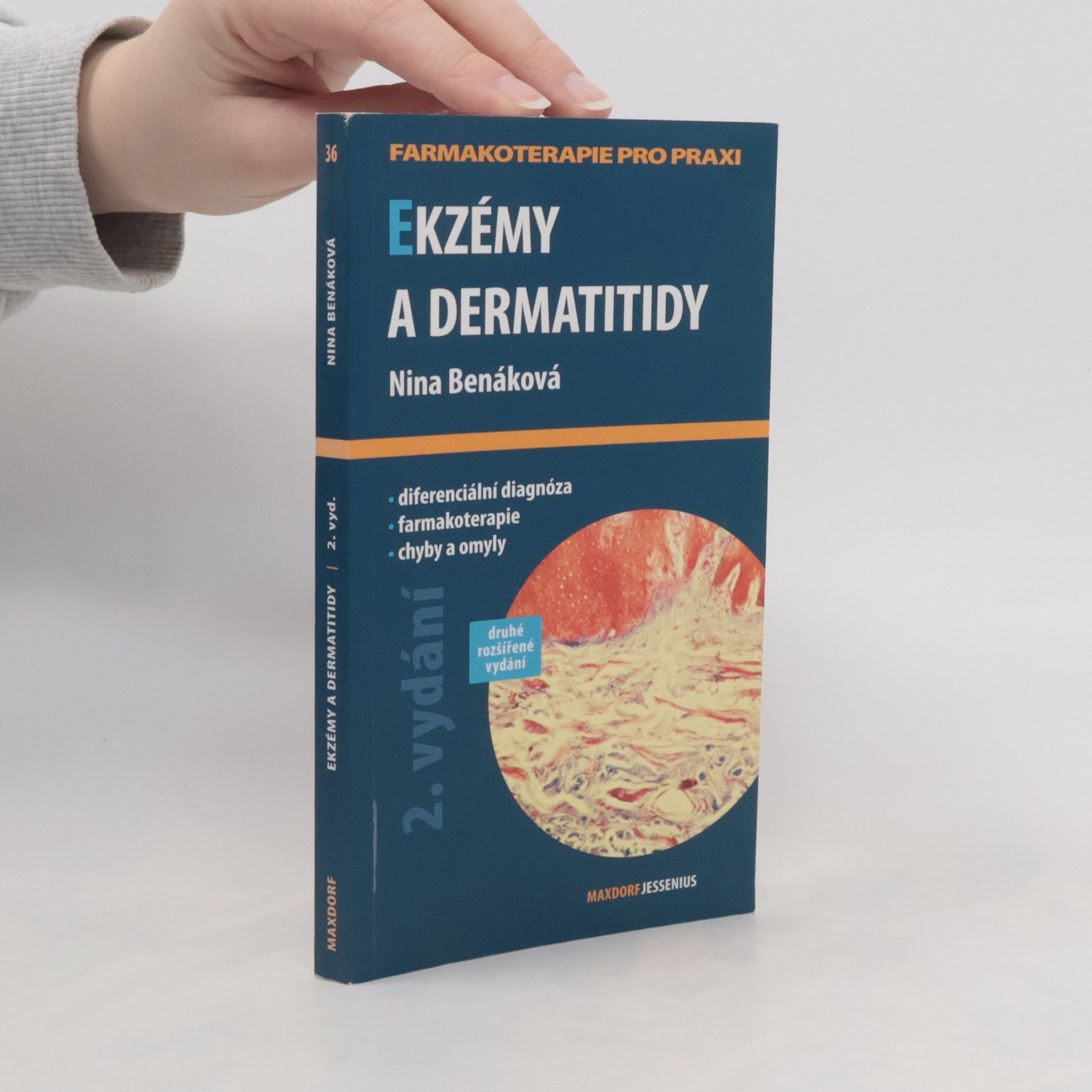 Nina Benáková Ekzémy a dermatitidy
