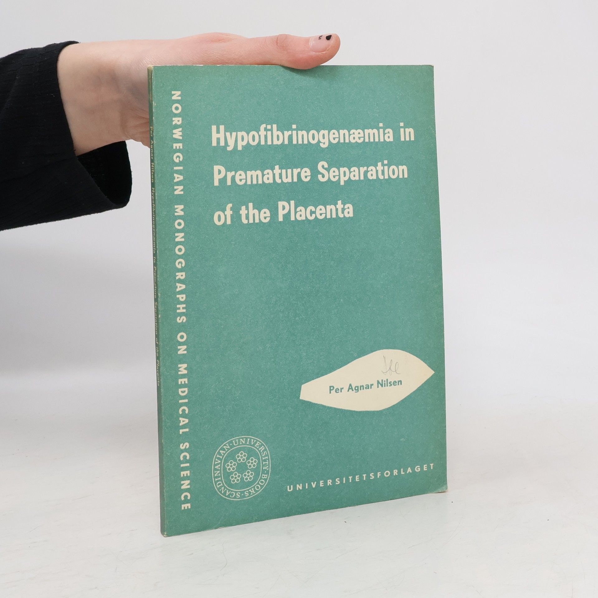 Per Agnar Nilsen Hypofibrinogenæmia in Premature Separation of the Placenta