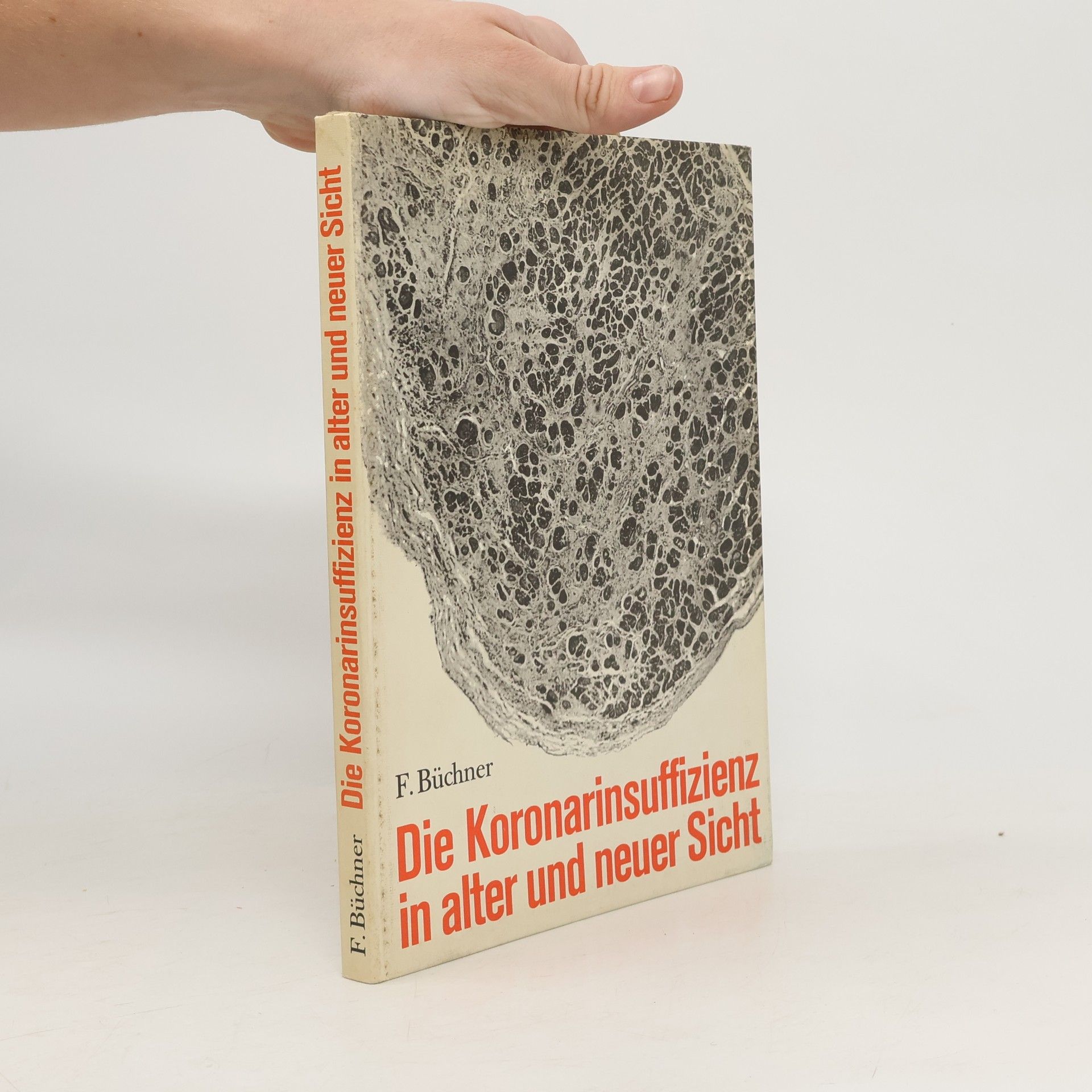 Die Koronarinsuffizienz in alter und neuer Sicht