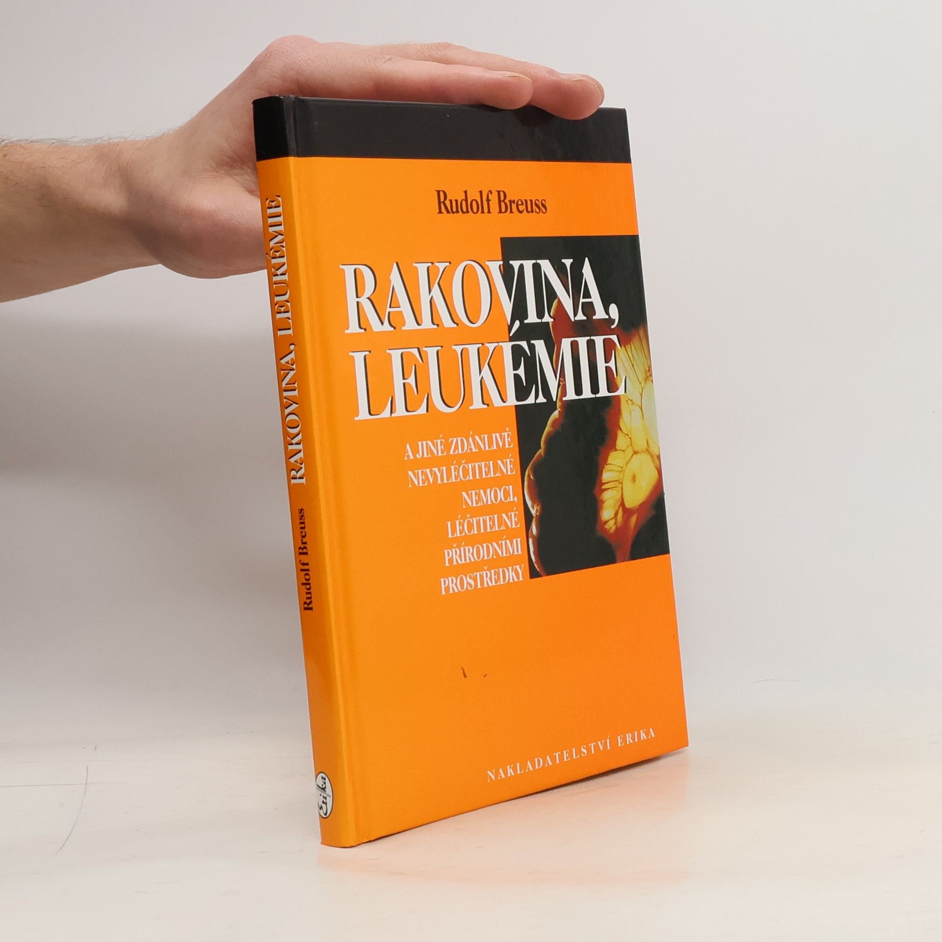 Rudolf Breuss Rakovina, leukémie a jiné zdánlivě nevyléčitelné nemoci, léčitelné přírodními prostředky