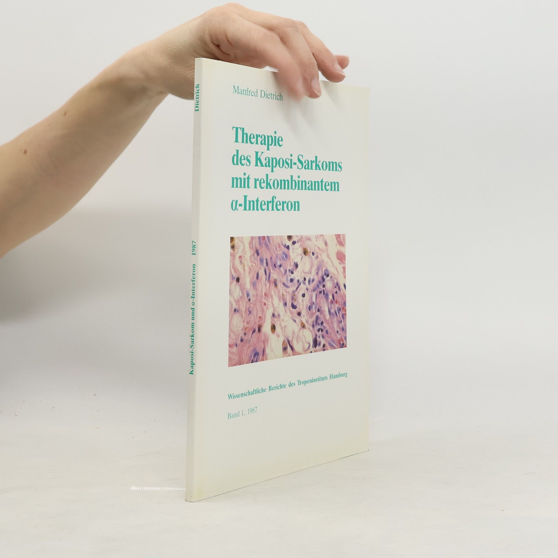 Manfred Dietrich Therapie des Kaposi-Sarkoms mit rekombinantem α-Interferon