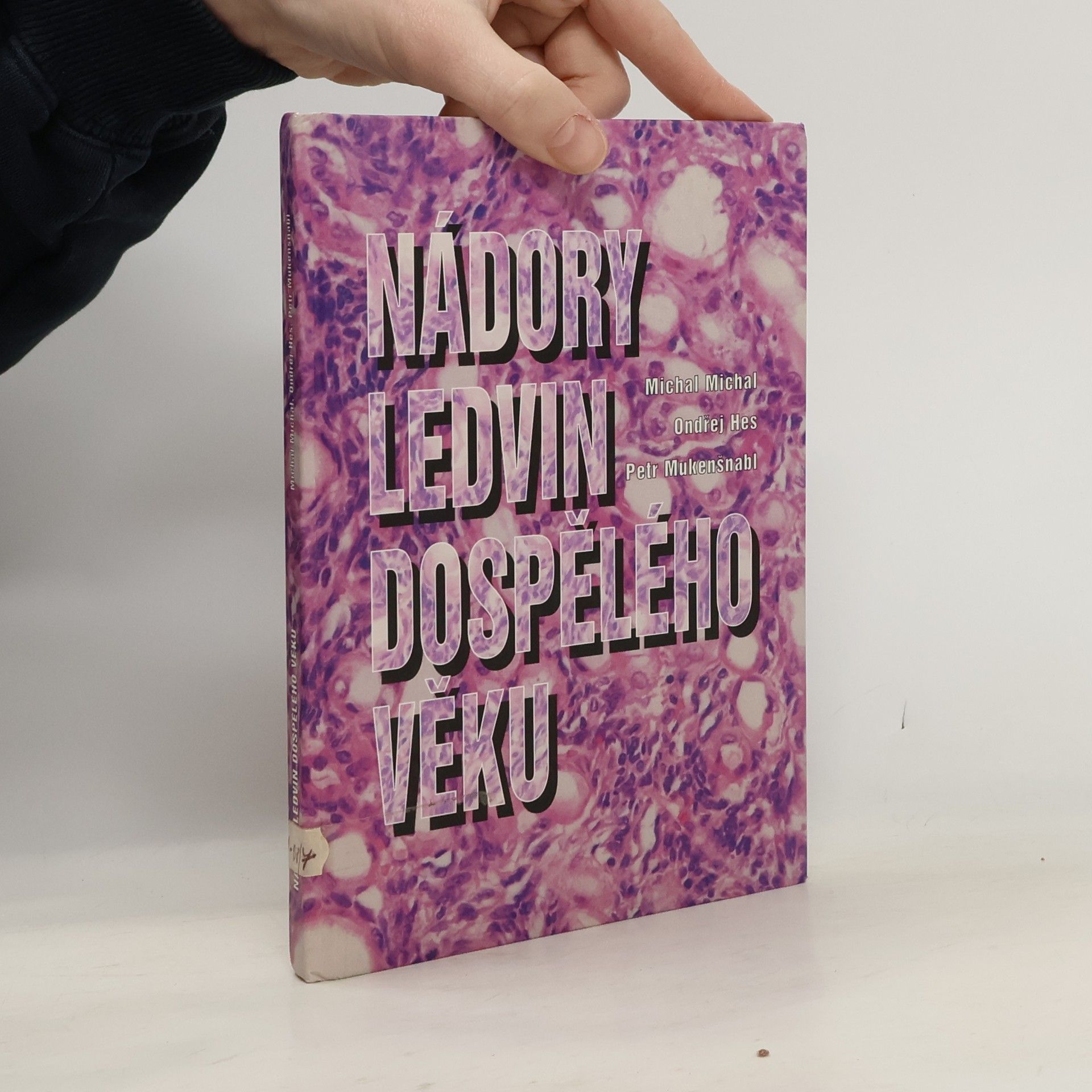 Nádory ledvin dospělého věku