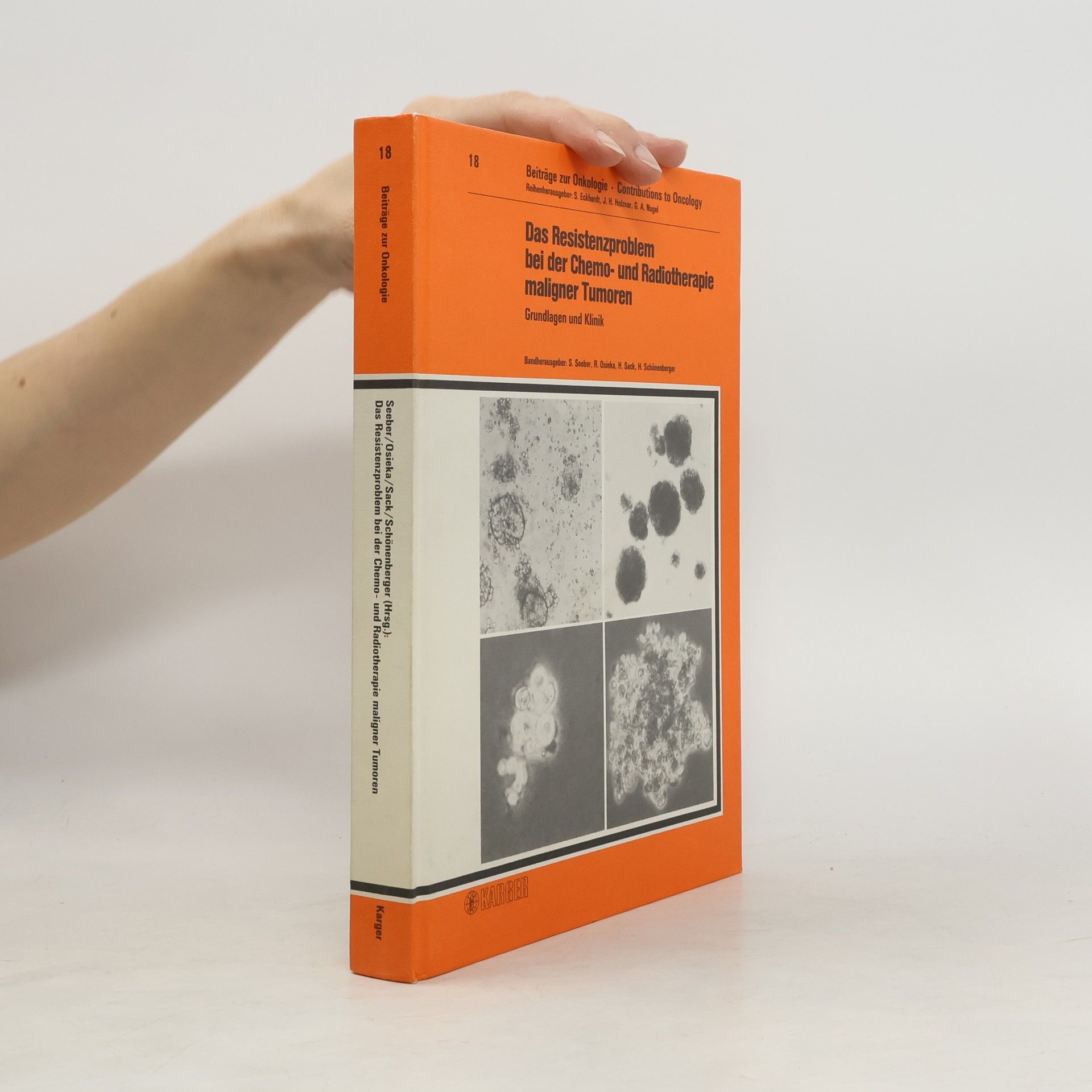 Siegfried Seeber Beiträge zur Onkologie - 18: Das Resistenzproblem bei der Chemo- und Radiotherapie maligner Tumoren