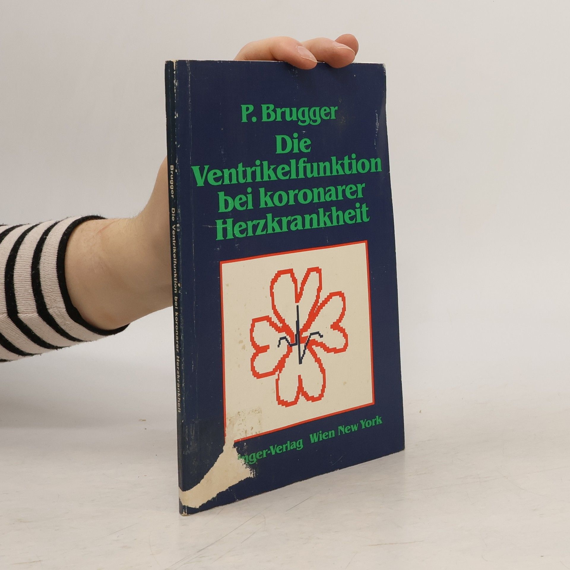 Paul Brugger Die Ventrikelfunktion bei koronarer Herzkrankheit