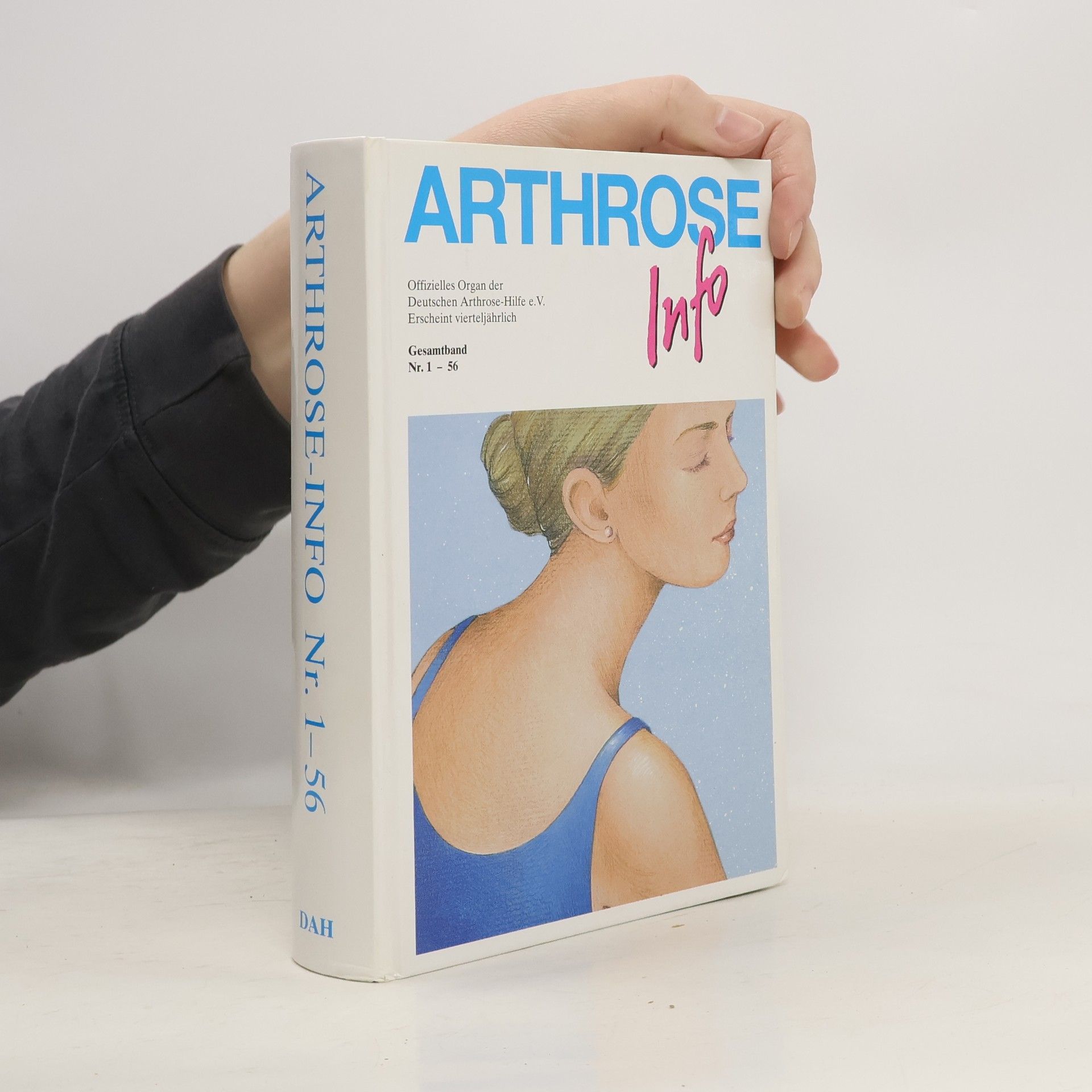 Autorenkollektiv Arthrose Info 1-56