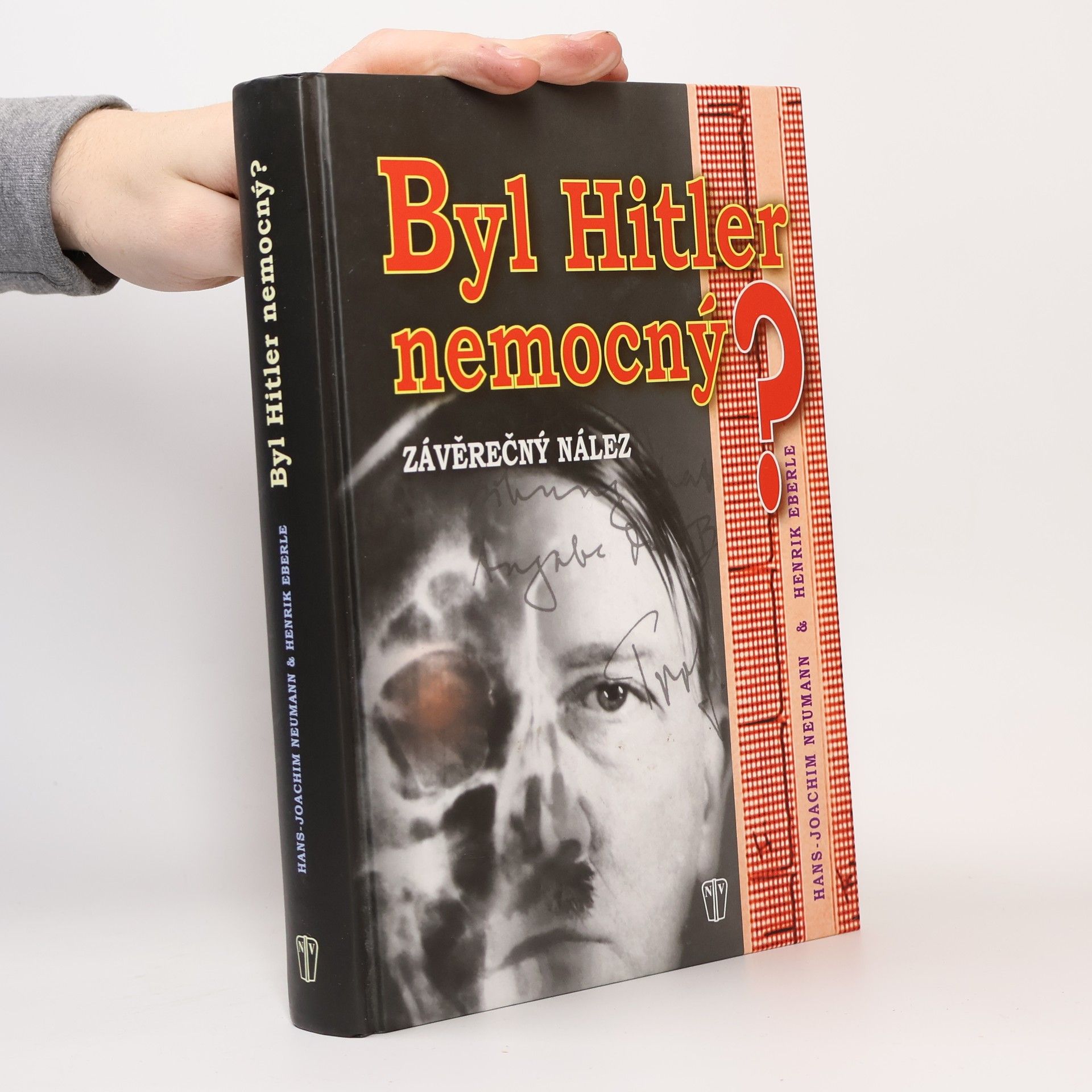 Hans-Joachim Neumann Byl Hitler nemocný? Závěrečný nález