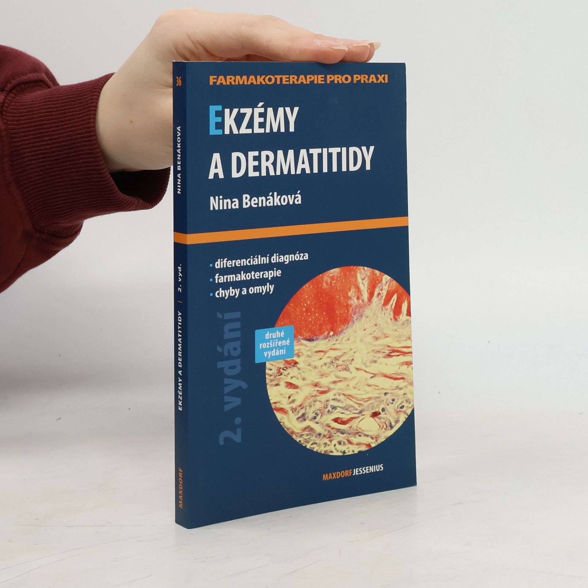 Ekzémy a dermatitidy