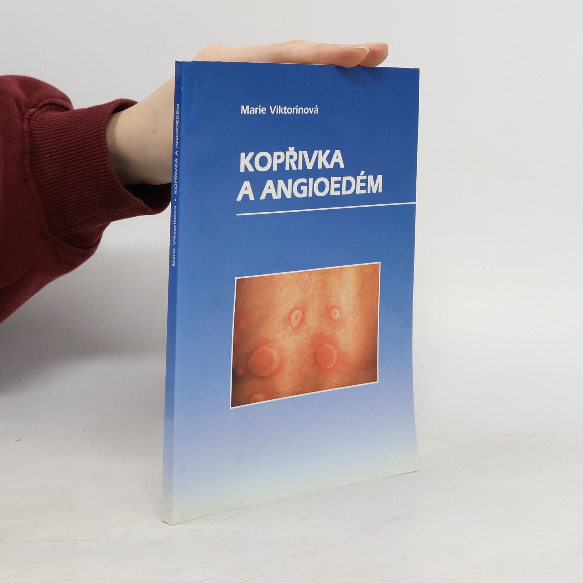 Marie Viktorinová Kopřivka a angioedém