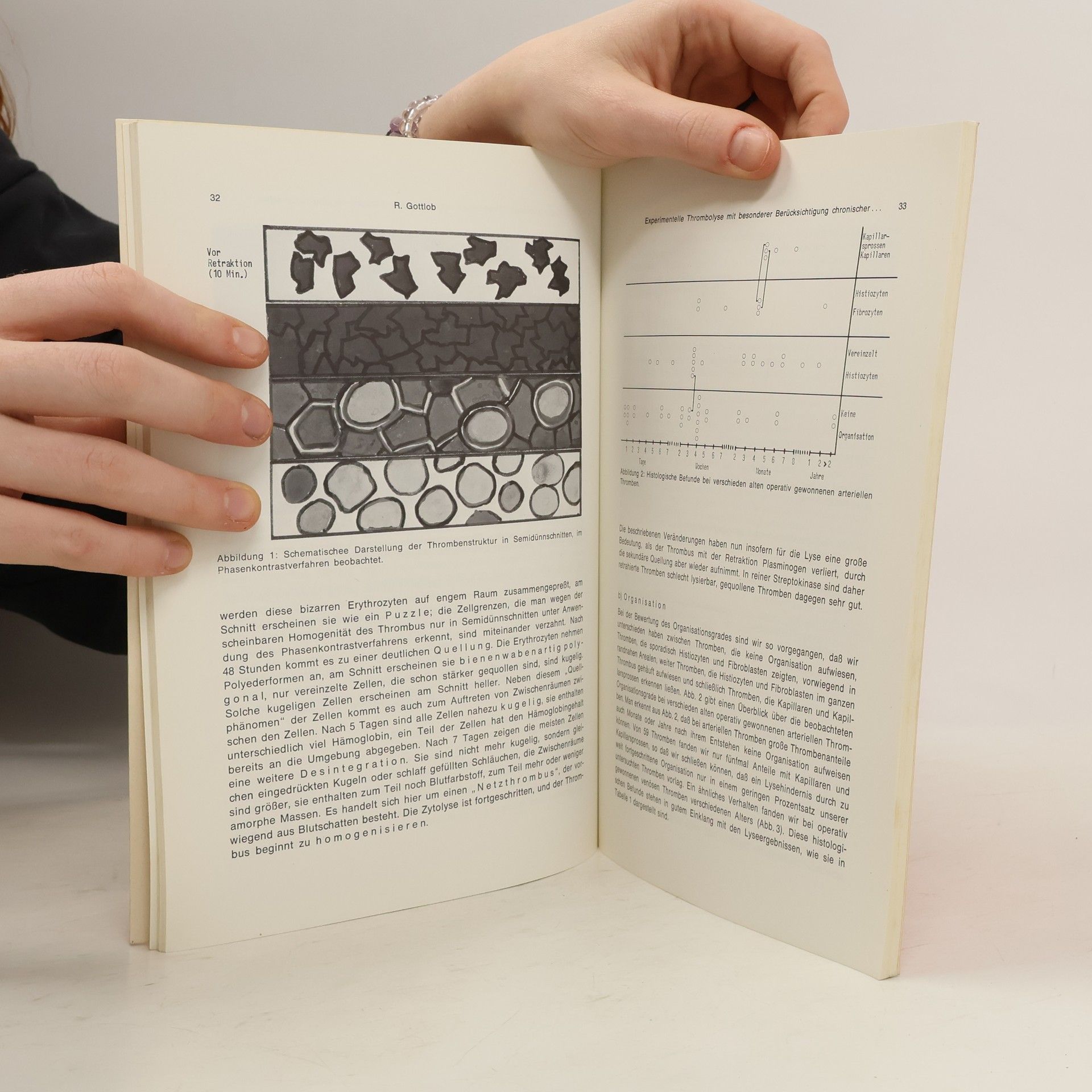 Autorenkollektiv Folia Angiologica 1