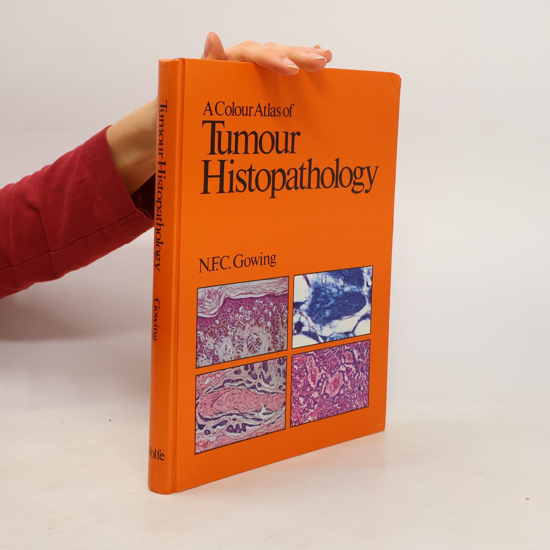 Noel F. C. Gowing A Colour Atlas of Tumour Histopathology