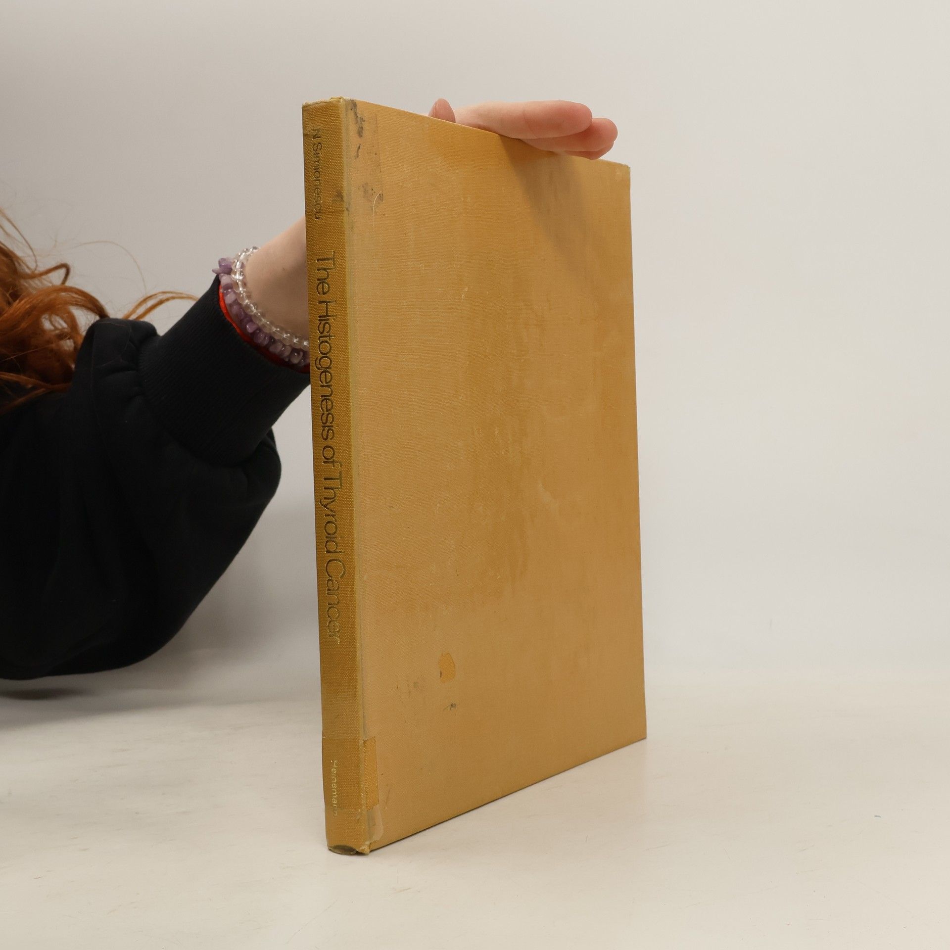 Nicolae Simionescu Histogenesis of Thyroid Cancer