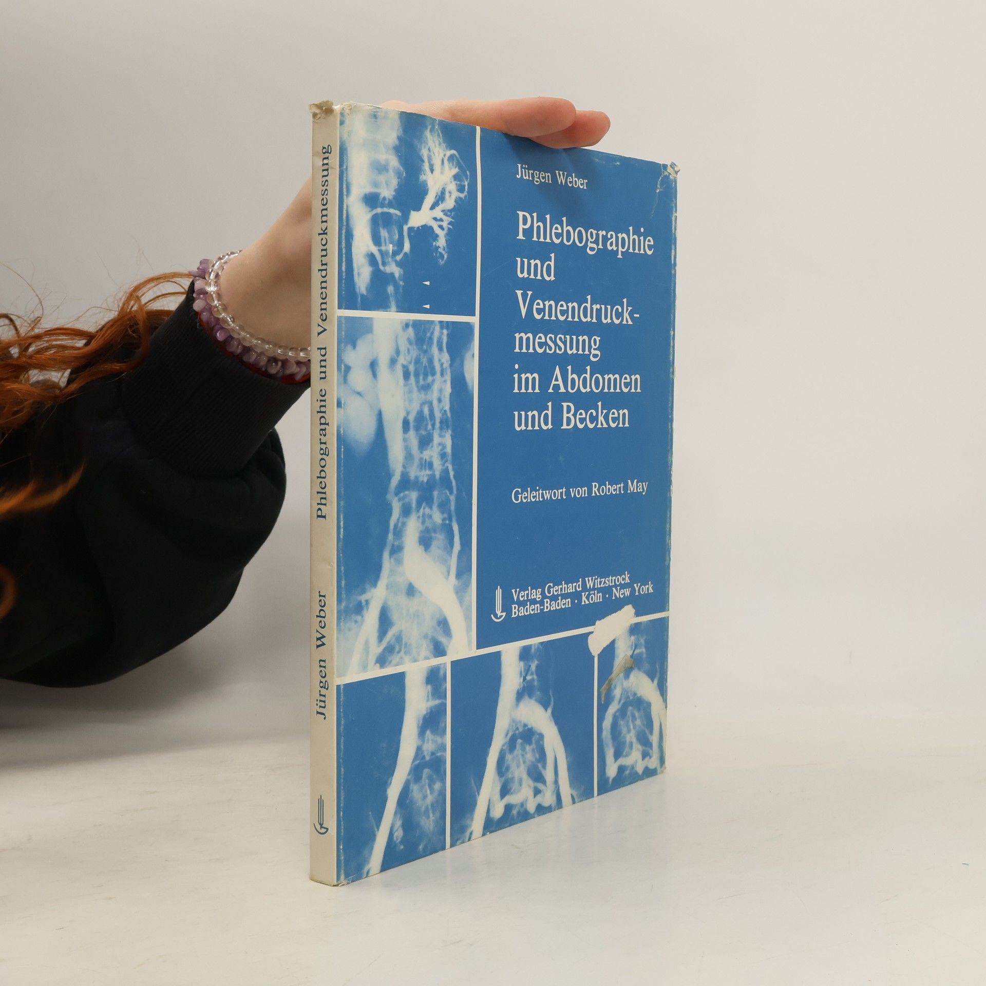 Phlebographie und Venendruckmessung im Abdomen und Becken