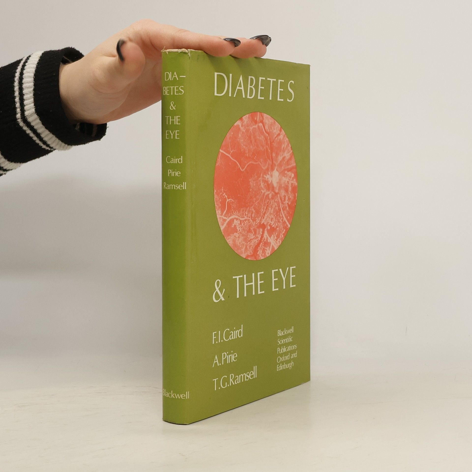 F.I. Caird Diabetes & The Eye