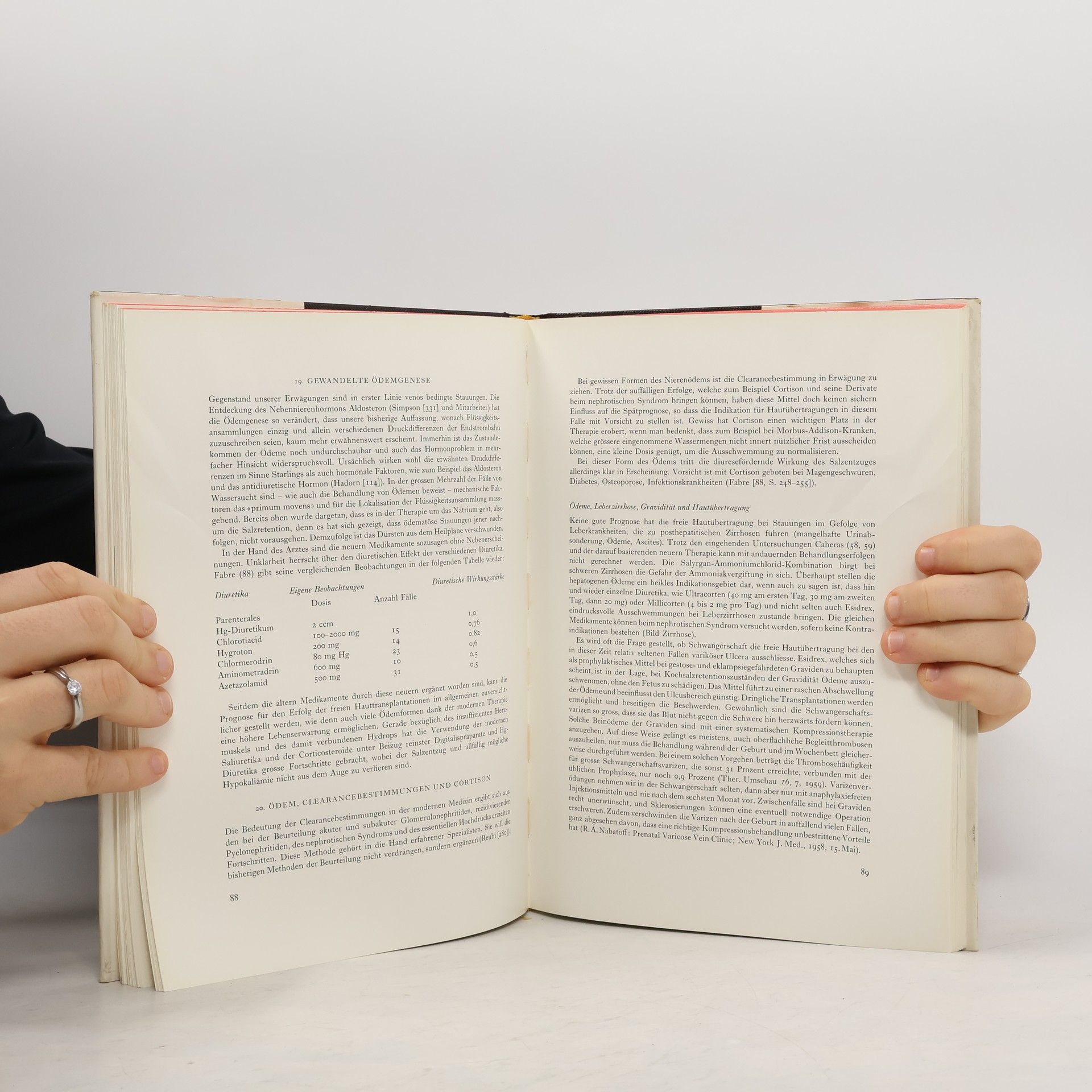 F. Zwinggi. Beingeschwüre, Varizen und Thrombosen