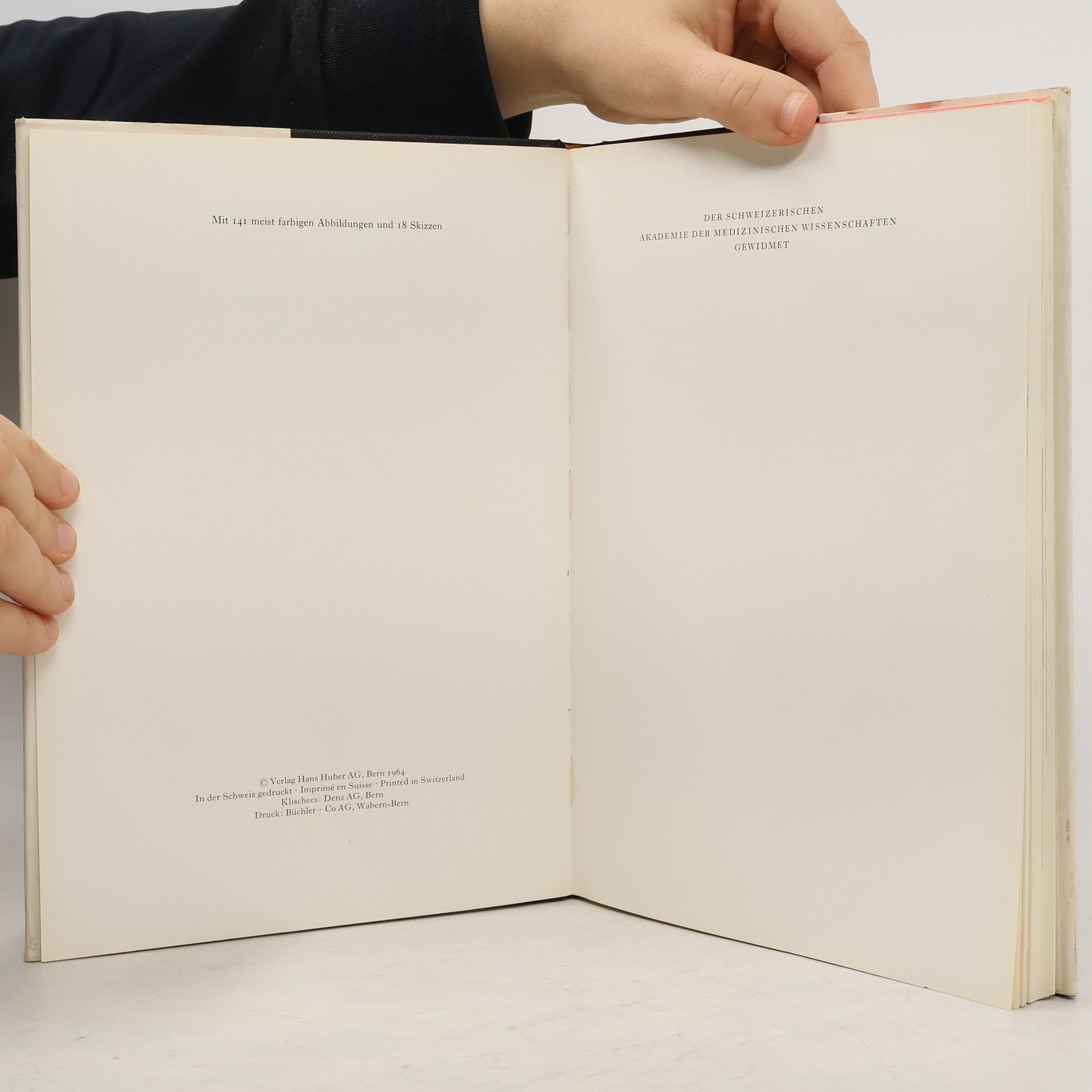 F. Zwinggi. Beingeschwüre, Varizen und Thrombosen