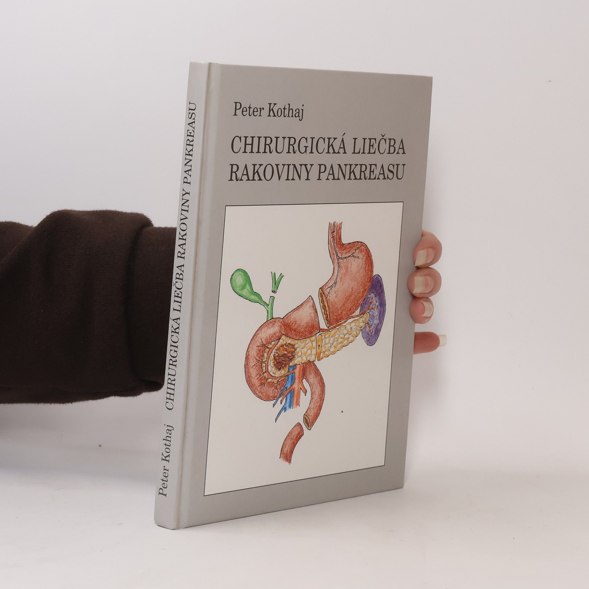 Peter Kothaj Chirurgická liečba rakoviny pankreasu