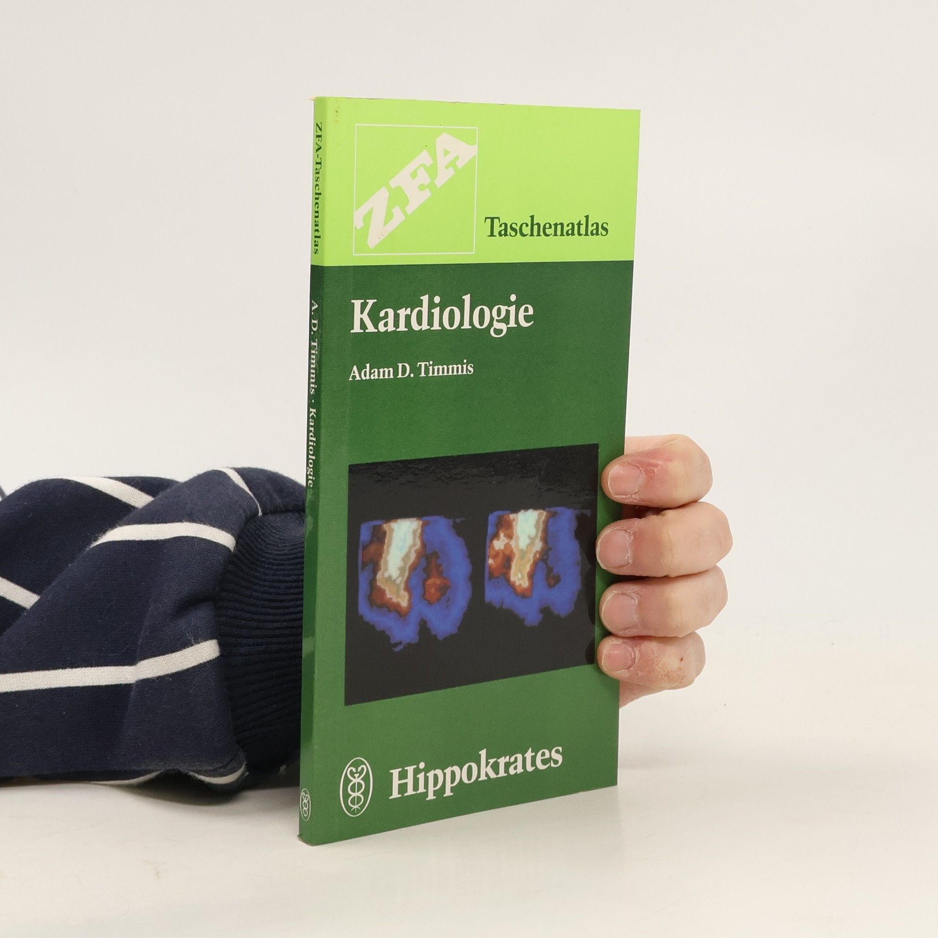 Autorenkollektiv Herzschutz mit Adalat: Für alle Formen und Schwere-grade der KHK