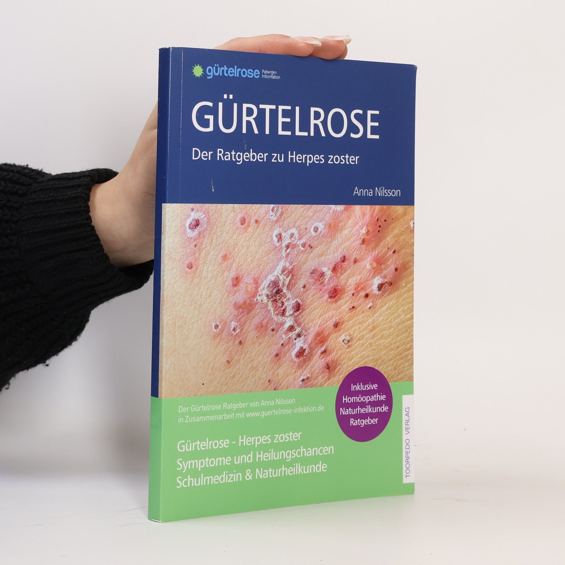 Fr Anna Nilsson Gürtelrose - Der große Ratgeber zu Herpes zoster