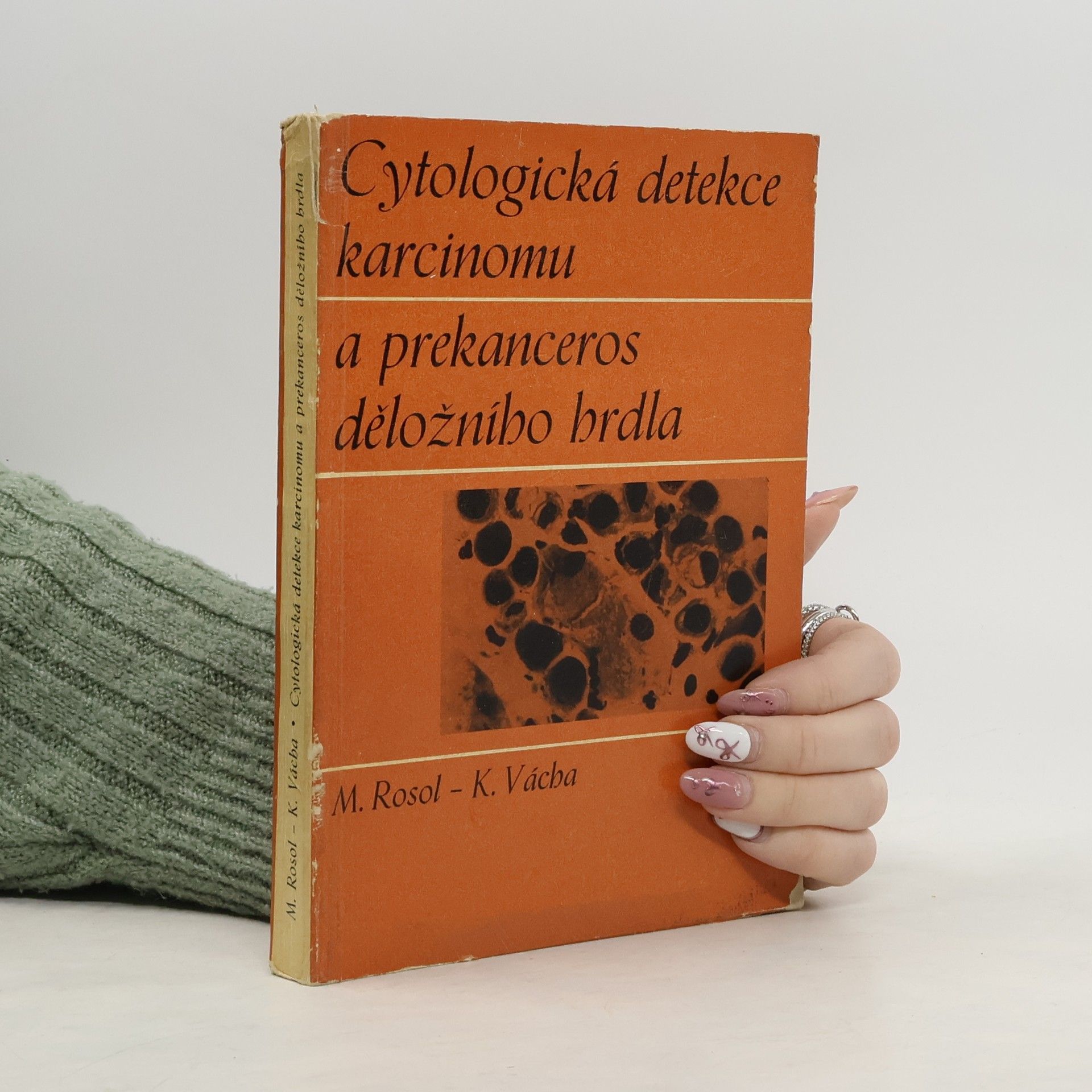 M. Rosol Cytologická detekce karcinomu a prekanceros děložního hrdla