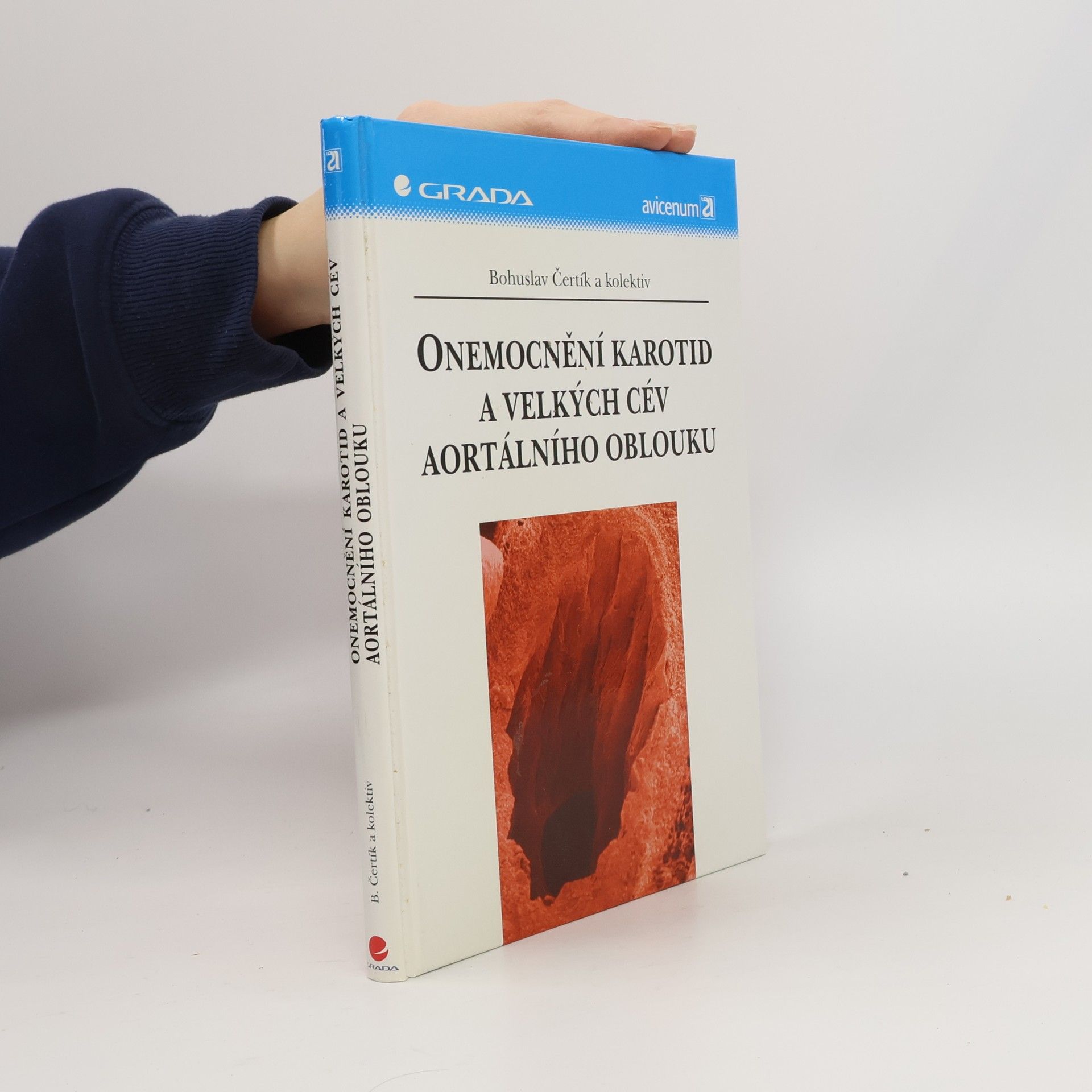 Bohuslav Čertík Onemocnění karotid a velkých cév aortálního oblouku
