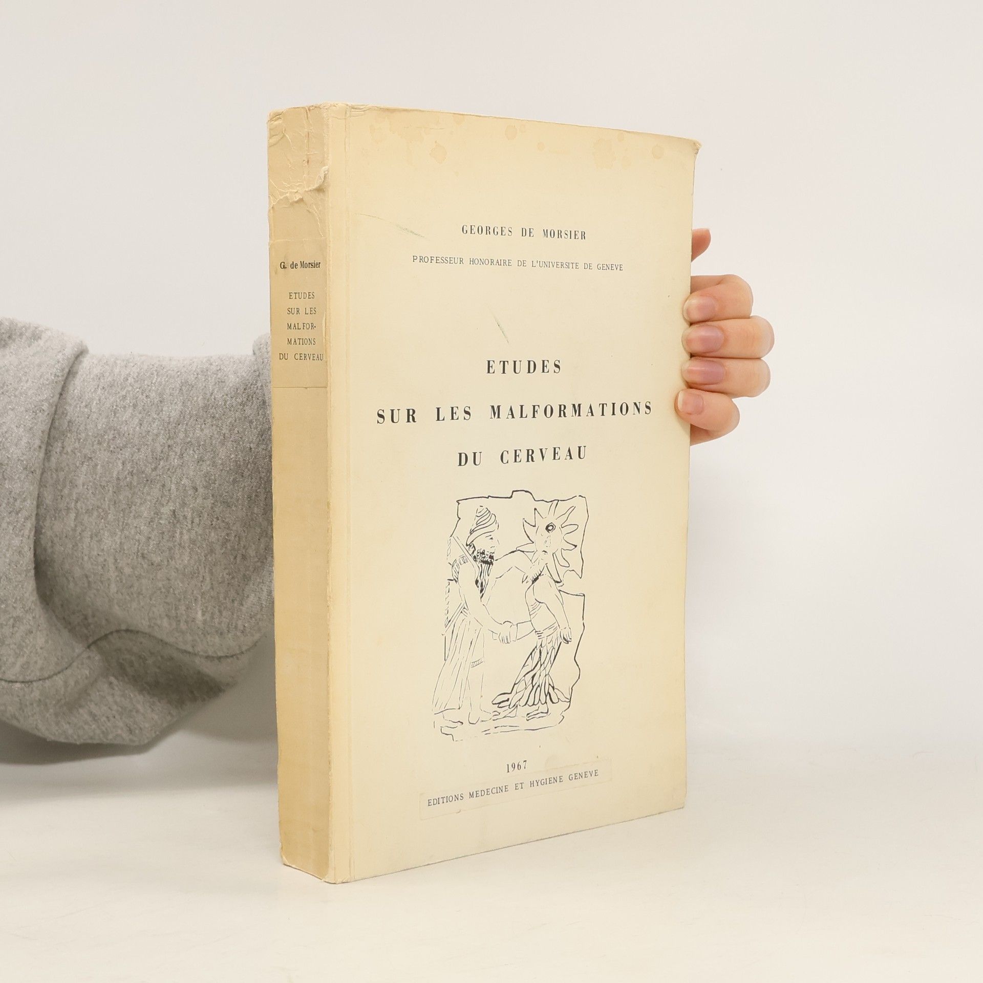 Georges de Morsier Études sur les malformations du cerveau