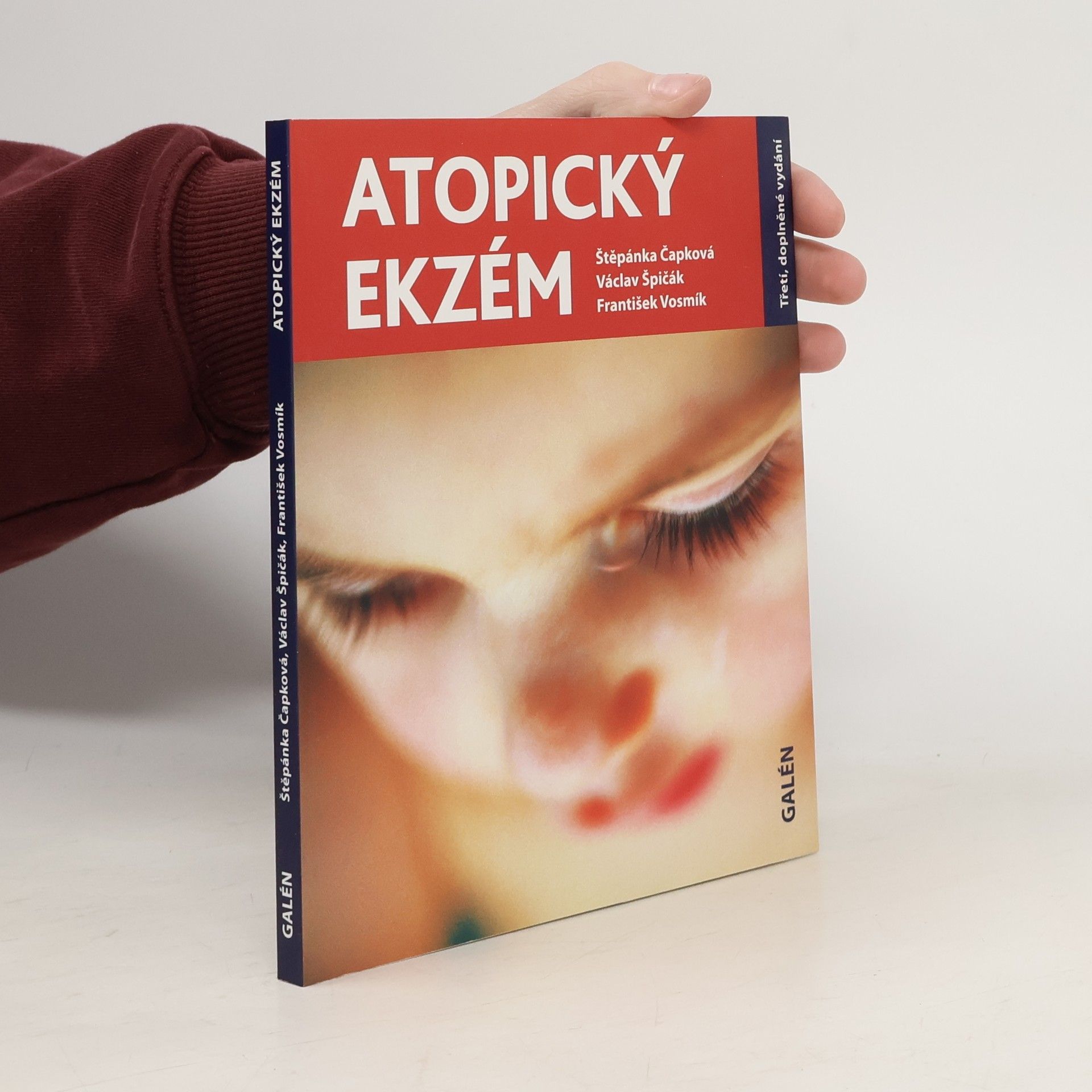 Štěpánka Čapková Atopický ekzém