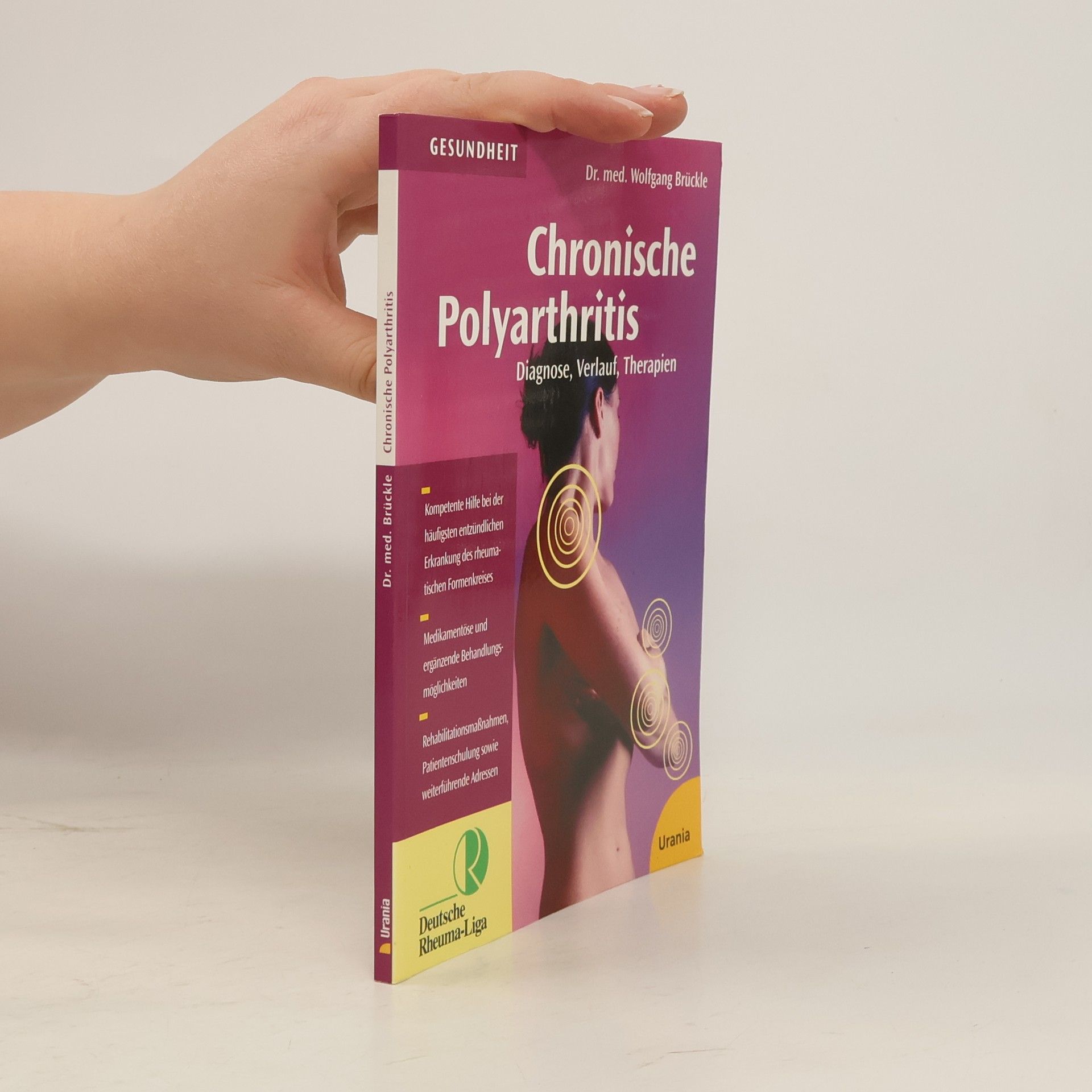 Dr. med. Wolfgang Brückle Chronische Polyarthritis